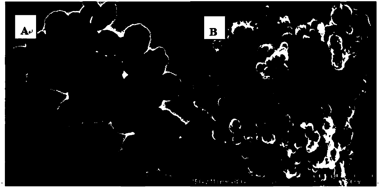 Method for detecting specific immune globulin E of eriocheir sinensis