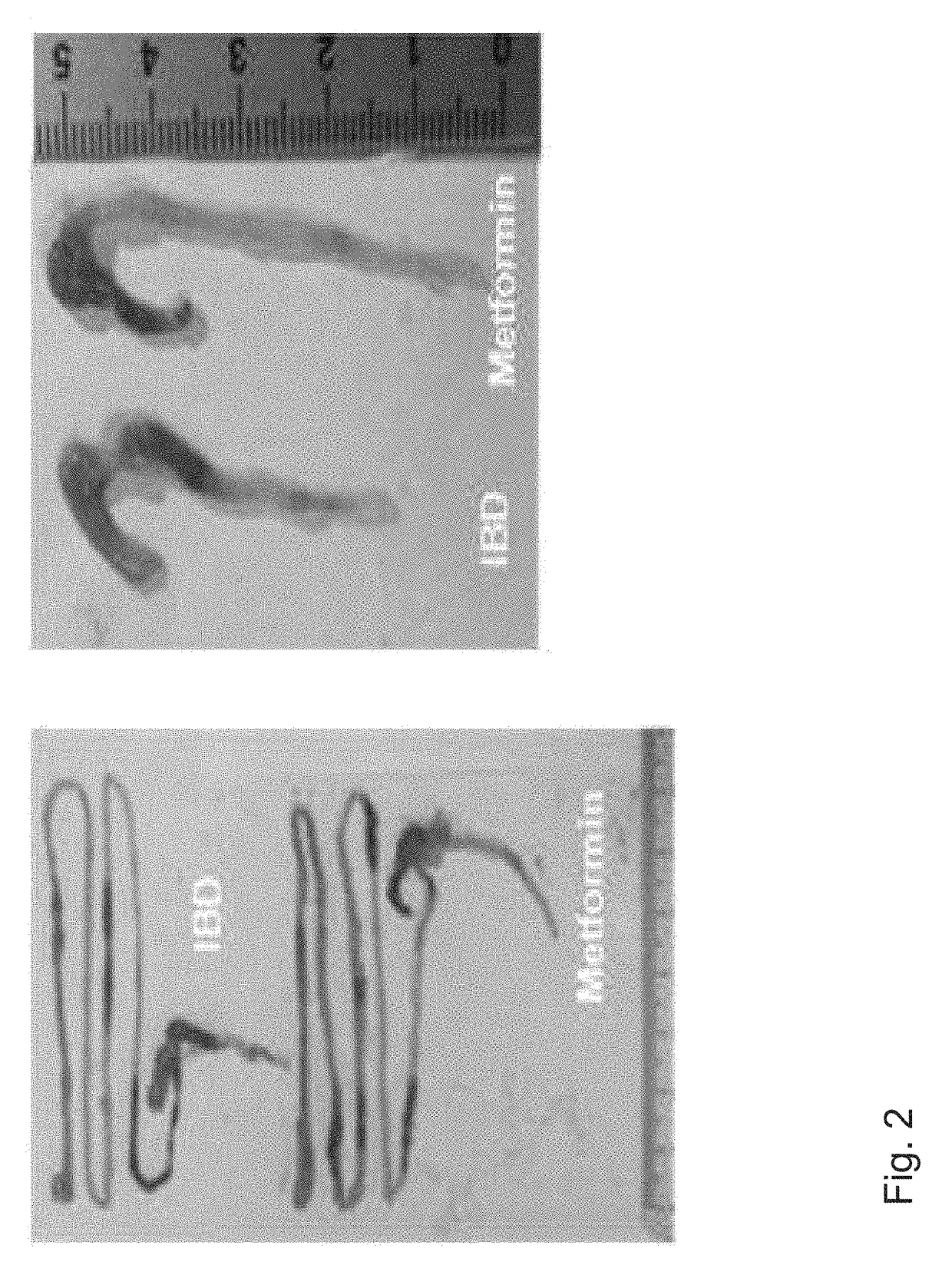 Composition comprising metformin as active ingredient for preventing or treating inflammatory bowel disease