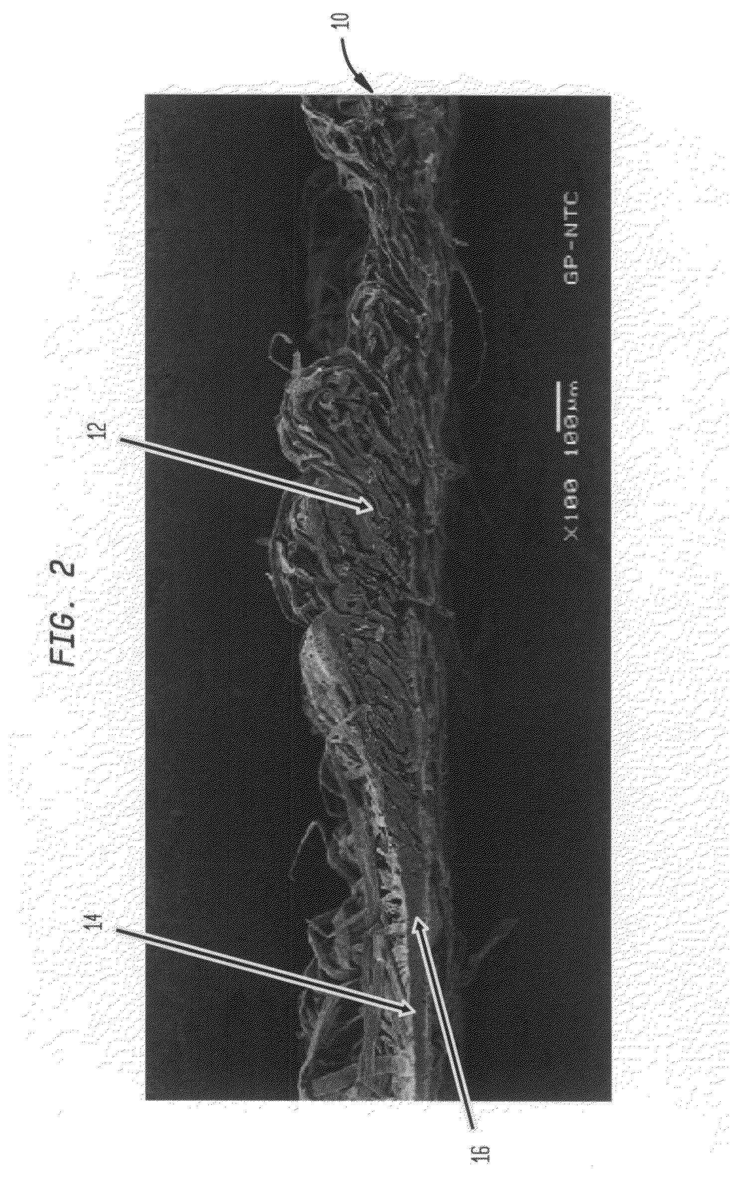 Fabric creped absorbent sheet with variable local basis weight