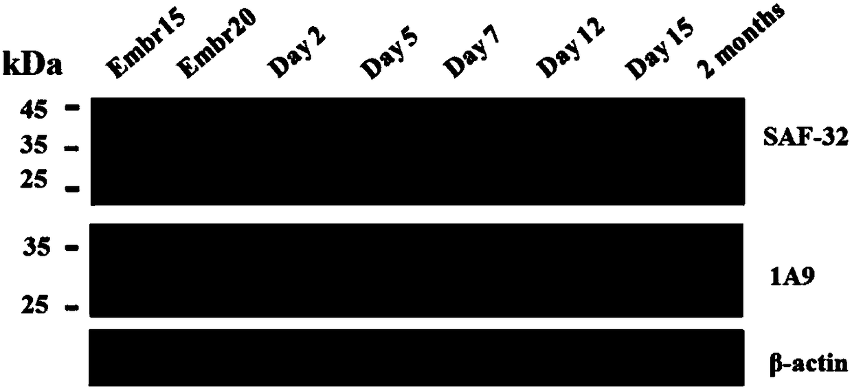 Monoclonal antibodies capable of specifically recognizing mouse protein Doppel