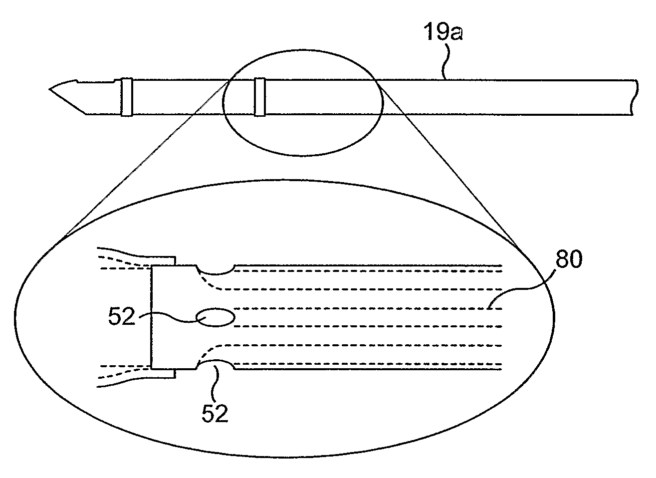 Artificial airway apparatus