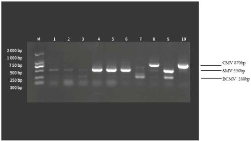 Primer for simultaneously detecting three viruses of CMV, SMV and BCMV in soybeans and detection method thereof