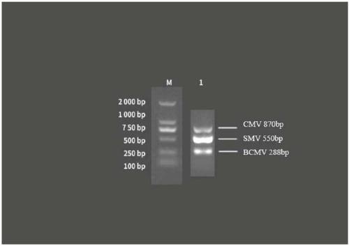 Primer for simultaneously detecting three viruses of CMV, SMV and BCMV in soybeans and detection method thereof