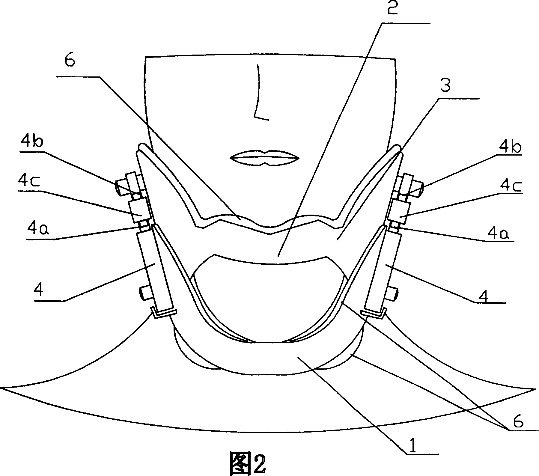 Traction device for treating cervical spondylosis