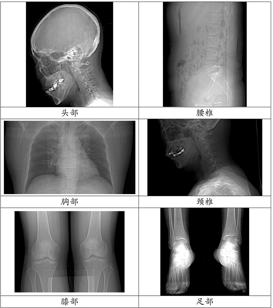 Setting method and device of scanned protocol