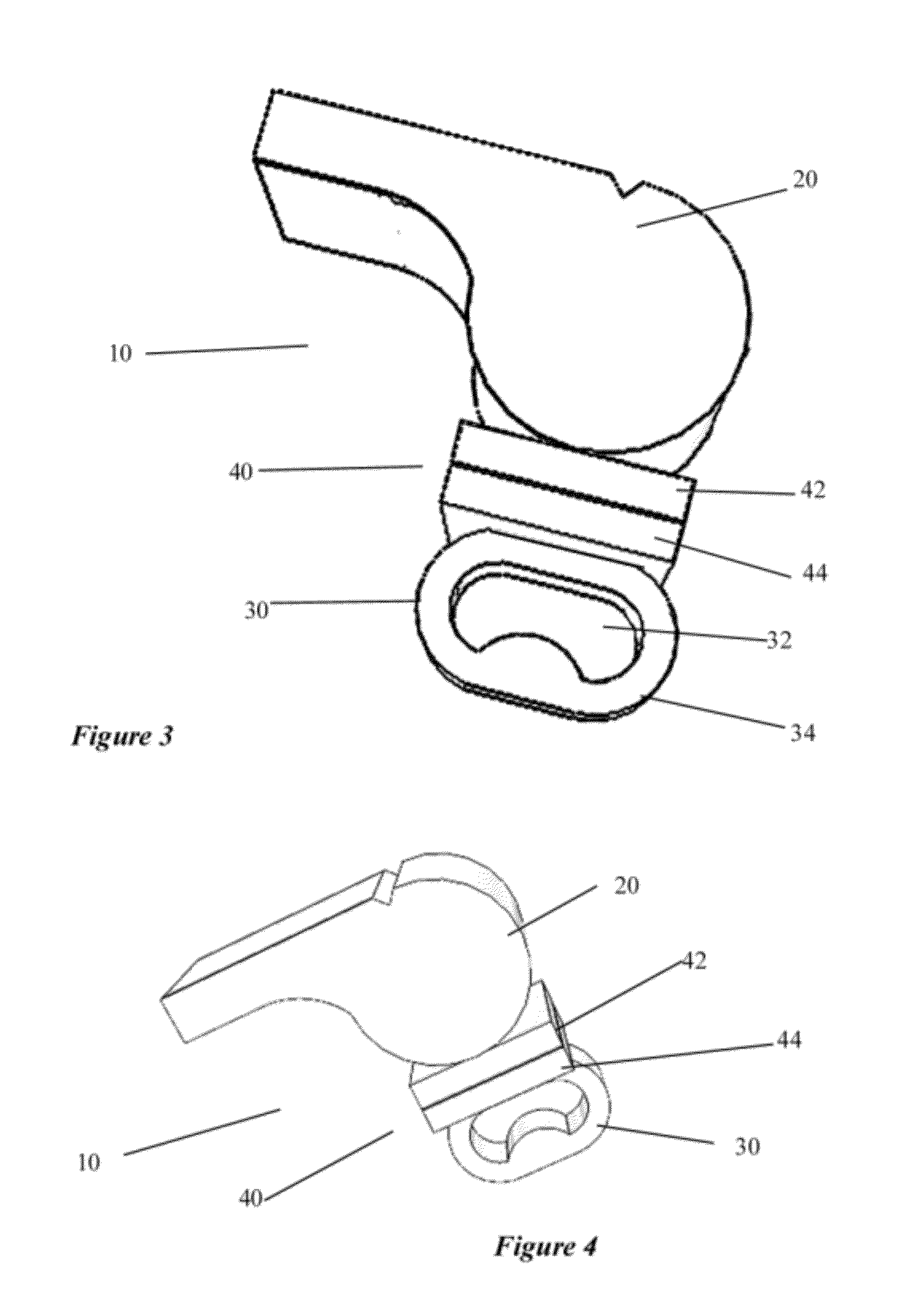 Detachable Fingergrip Whistle System