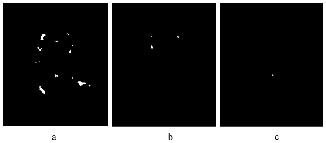 Image intensity standardization method for brain FLAIR nuclear magnetic resonance image