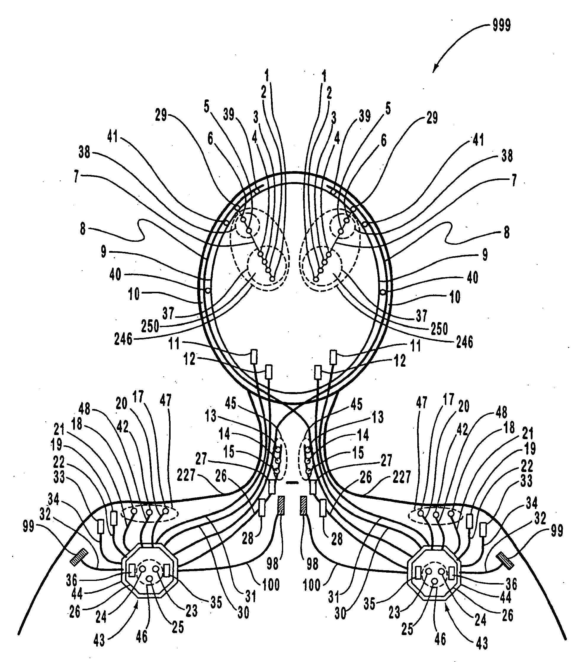 Systems and methods for monitoring a patient's neurological disease state