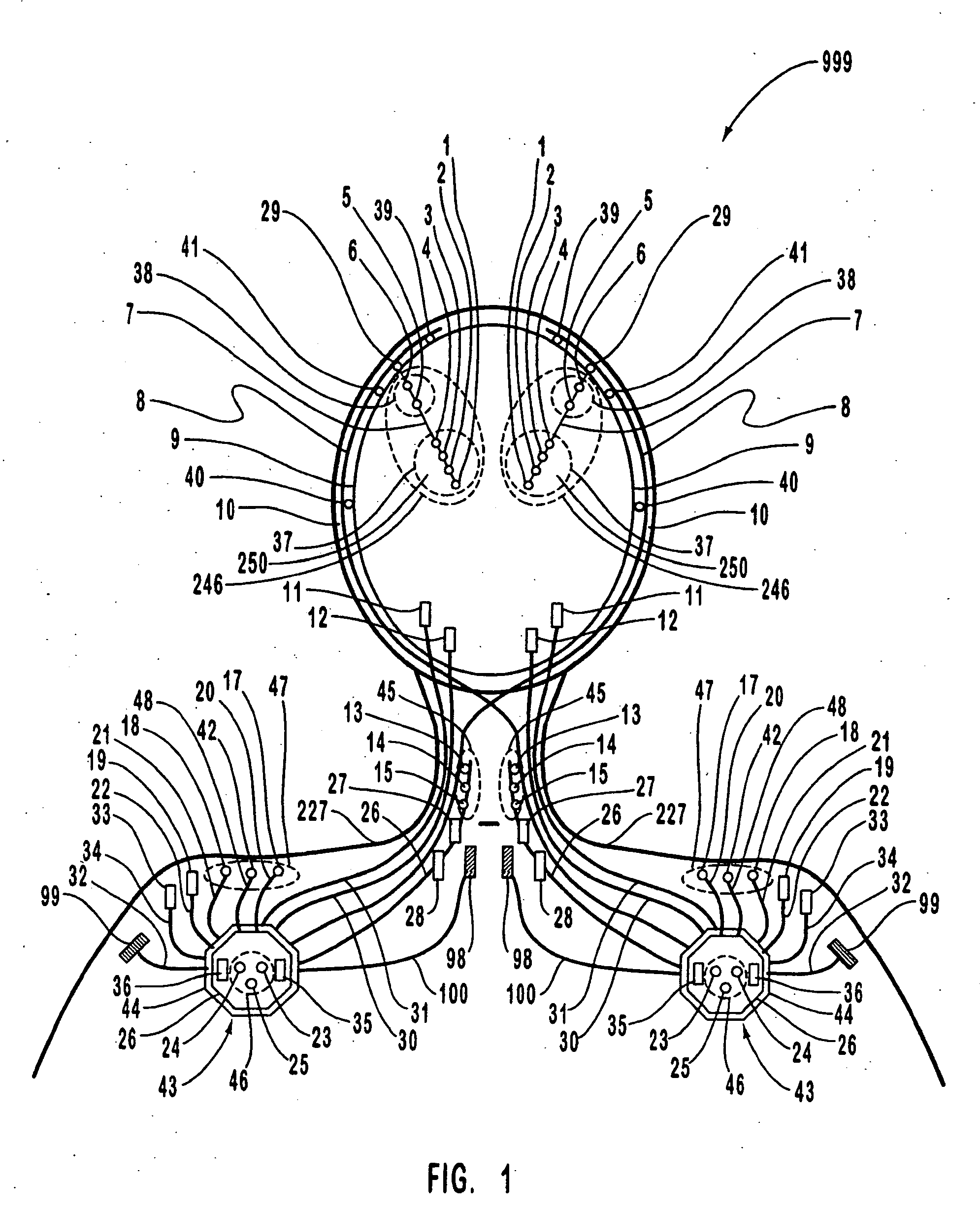 Systems and methods for monitoring a patient's neurological disease state