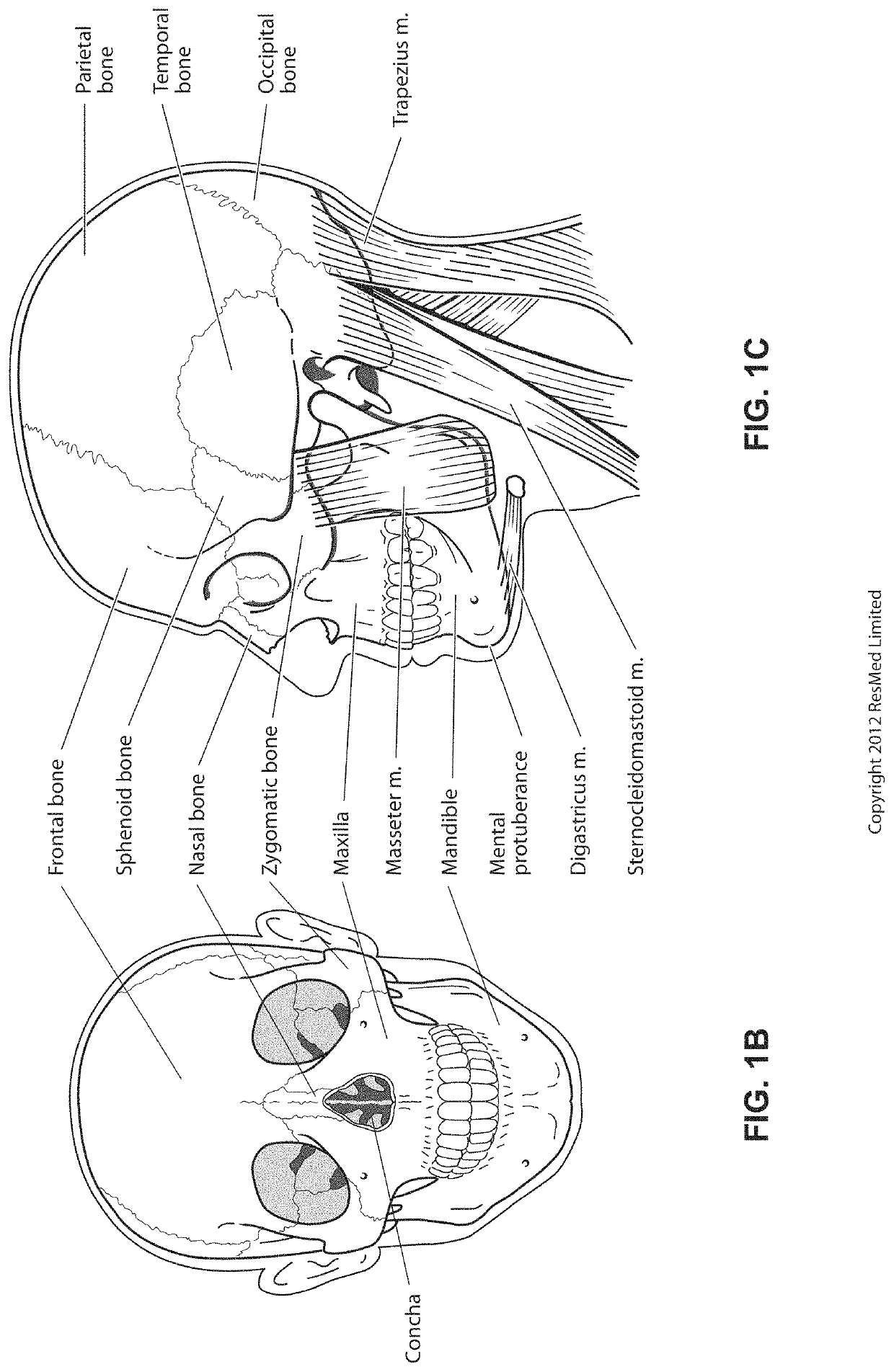 Positioning and stabilising structure and system incorporating same