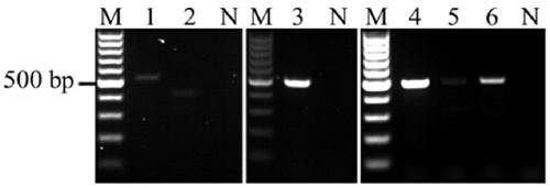 A multiplex PCR kit for detecting pathogens of bacterial meningitis