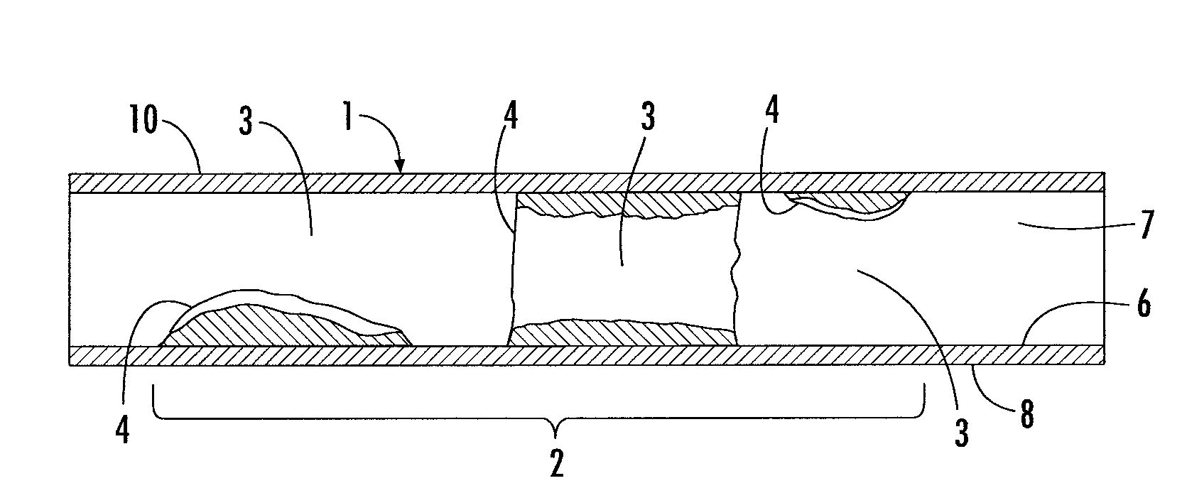 Method and apparatus for addressing vascular stenotic lesions