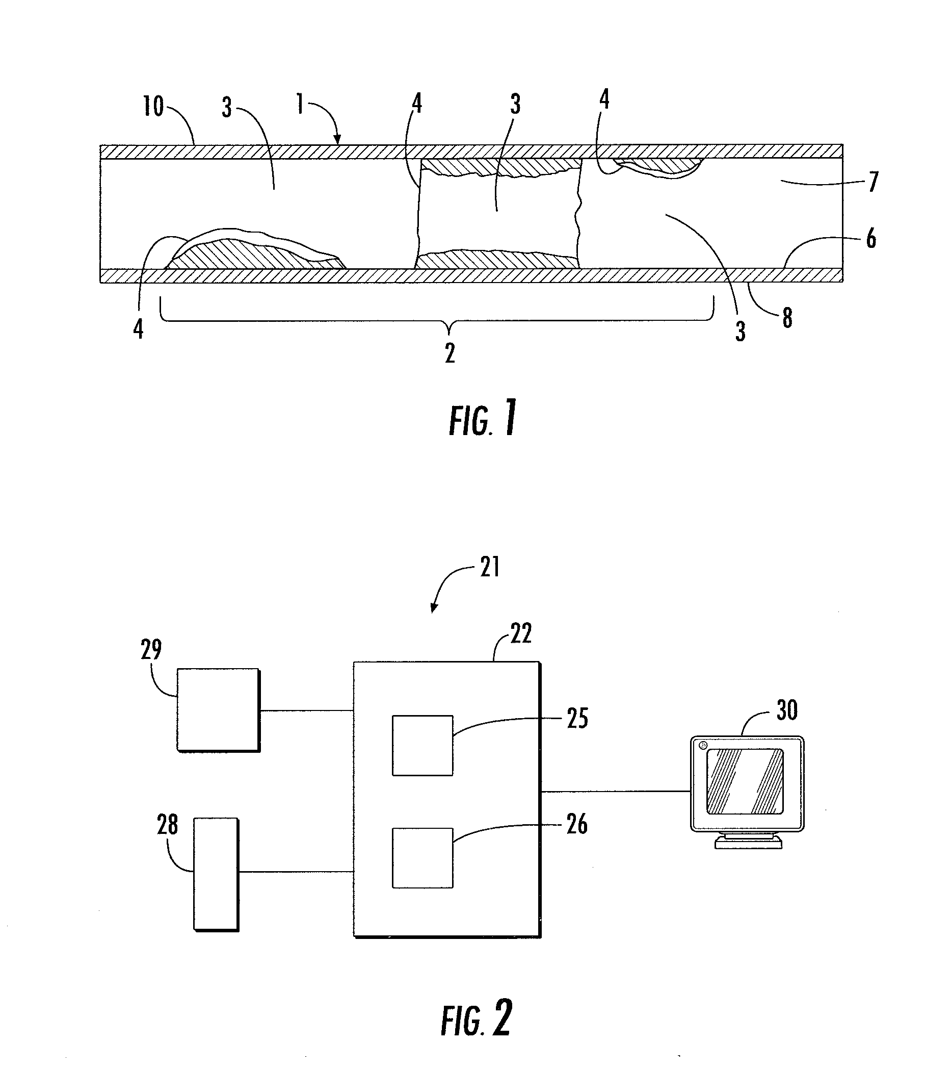 Method and apparatus for addressing vascular stenotic lesions