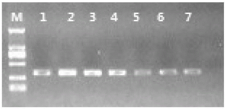 Specific primers and typing method of class II MHC (major histocompatibility complex) genes for antibacterial potential detection of alligator sinensis