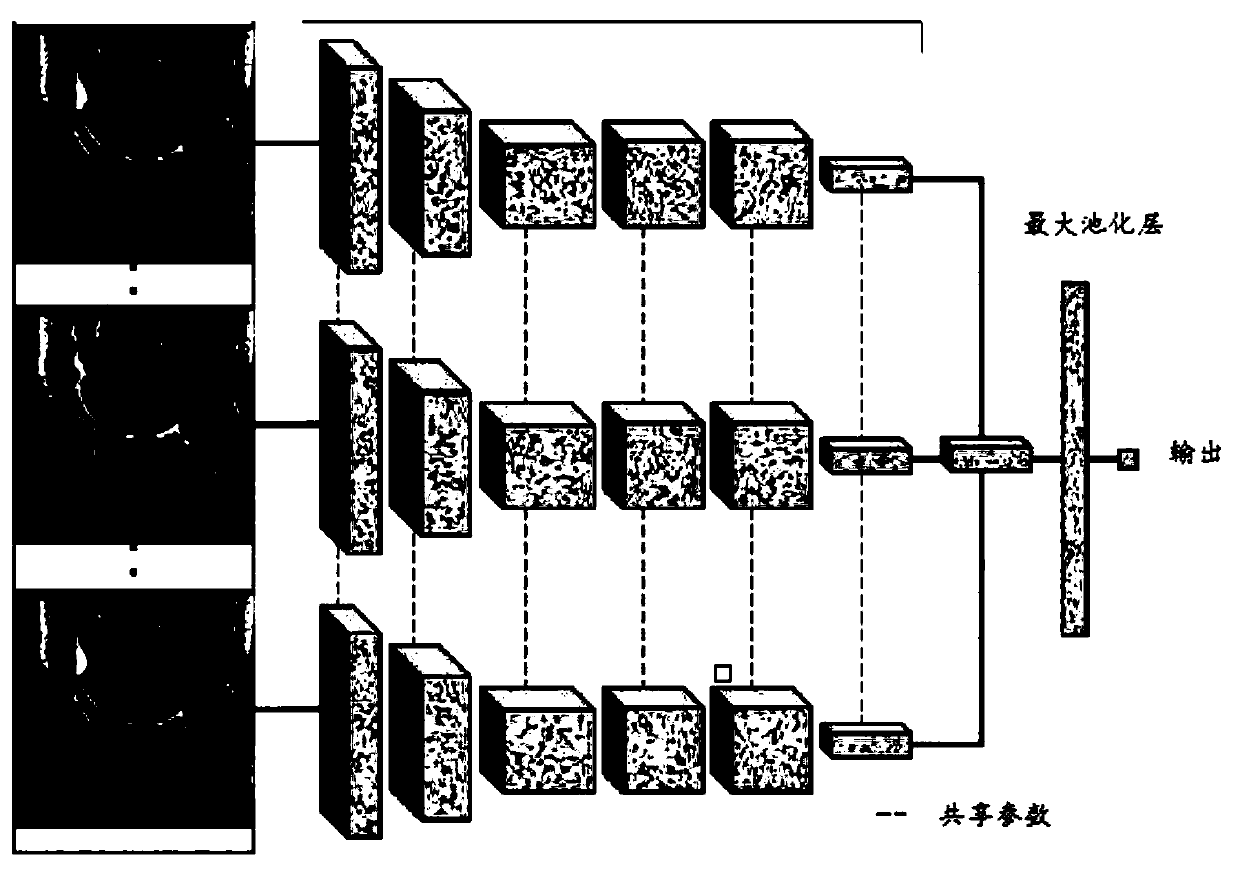 Eye image segmentation method and device based on prior information, equipment and medium