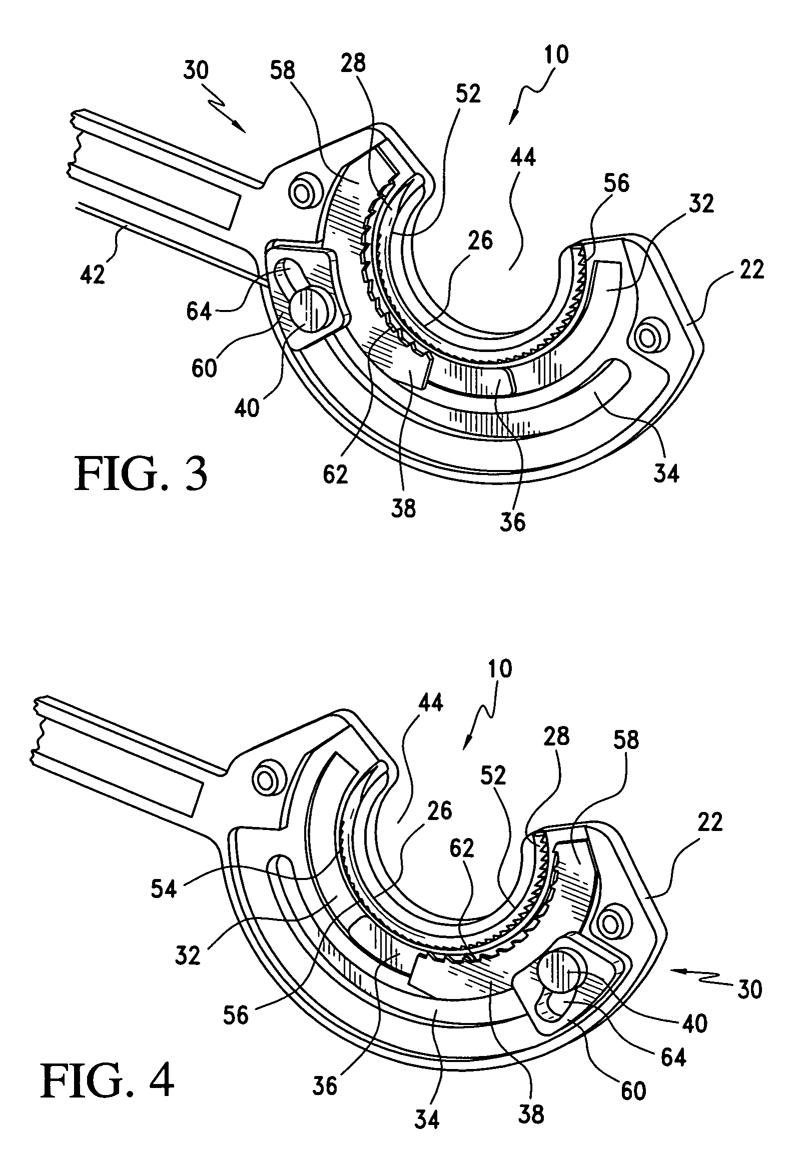 Surgical suturing apparatus with anti-backup system