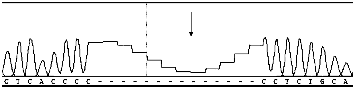 Kit for detecting mutation of pathogenic gene POU3F4 of inner-ear malformation/incomplete separation type-III cochlear malformation