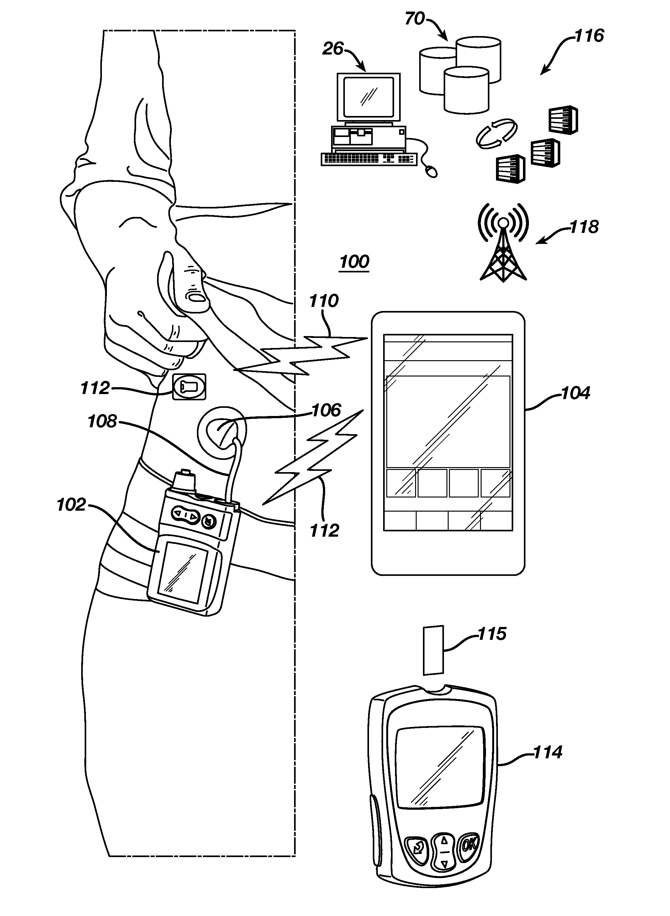 Method and system for management of diabetes with a glucose monitor and infusion pump to provide feedback on bolus dosing