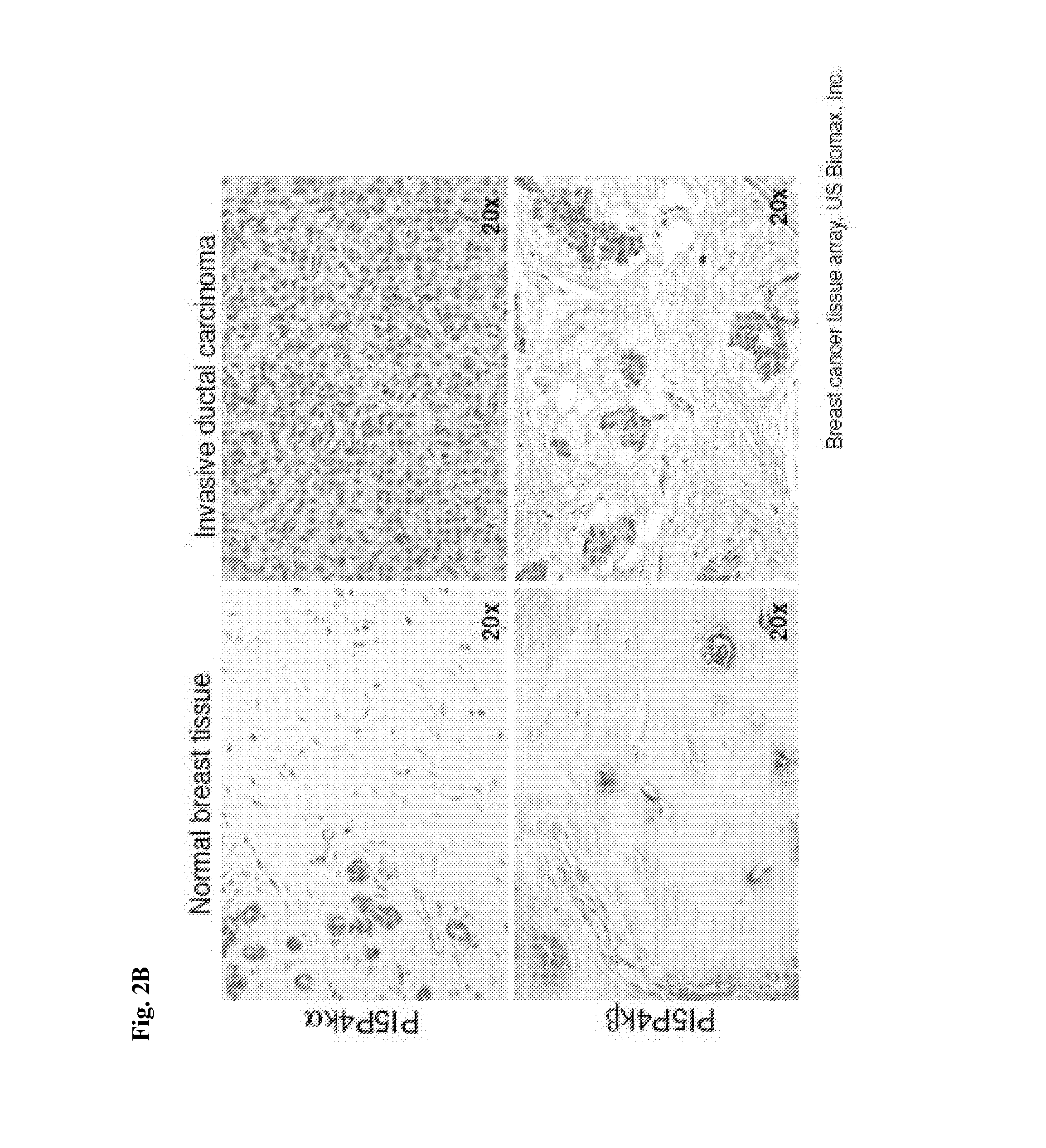 Modulation of phosphatidylinositol-5-phosphate-4-kinase activity