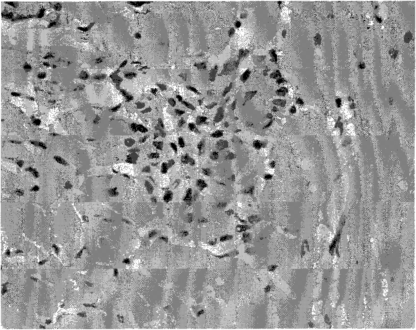 Anti-myocardial remodelling polypeptide, preparation method thereof, preparations and application thereof in preparation of anti-myocardial remodelling medicament