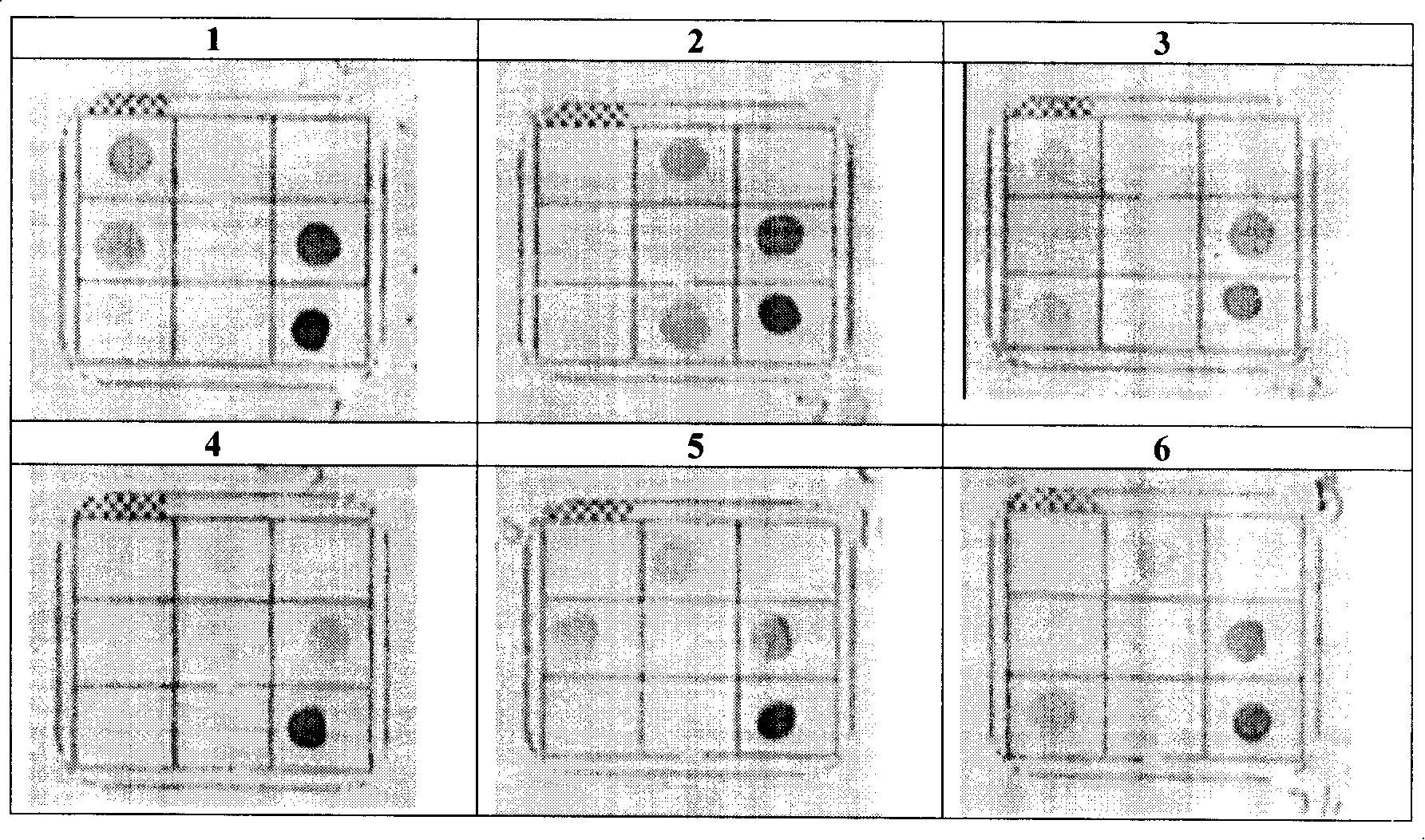 Method and reagent case for detecting hepatitis b virus anterior C/BCP region gene mutation