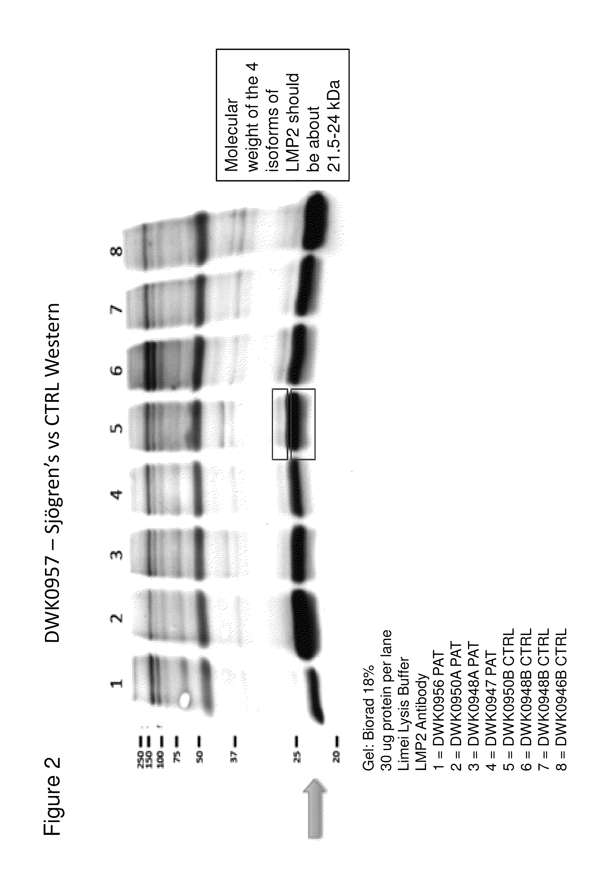 Methods and kits for diagnosing Sjögren's syndrome