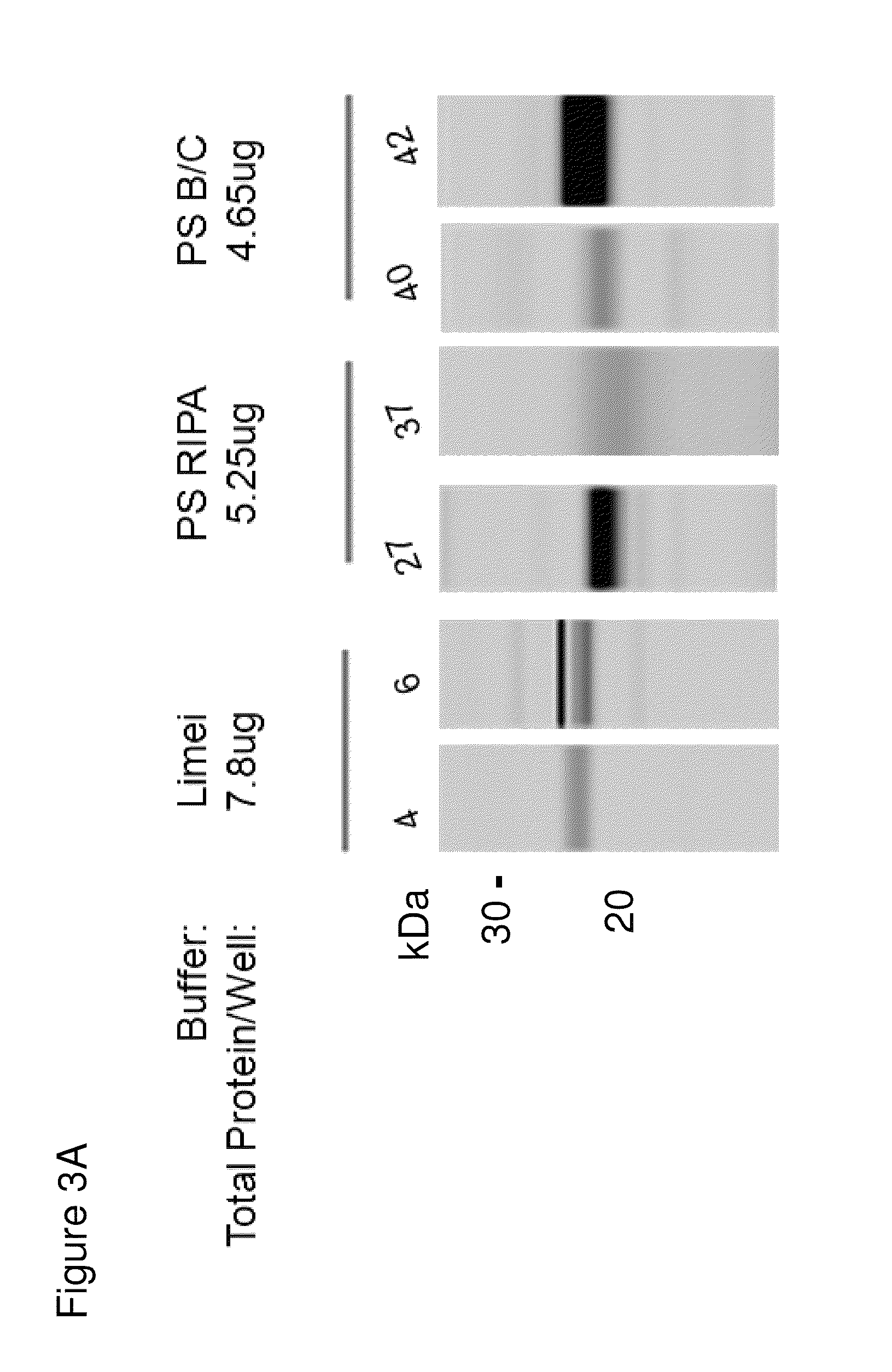 Methods and kits for diagnosing Sjögren's syndrome