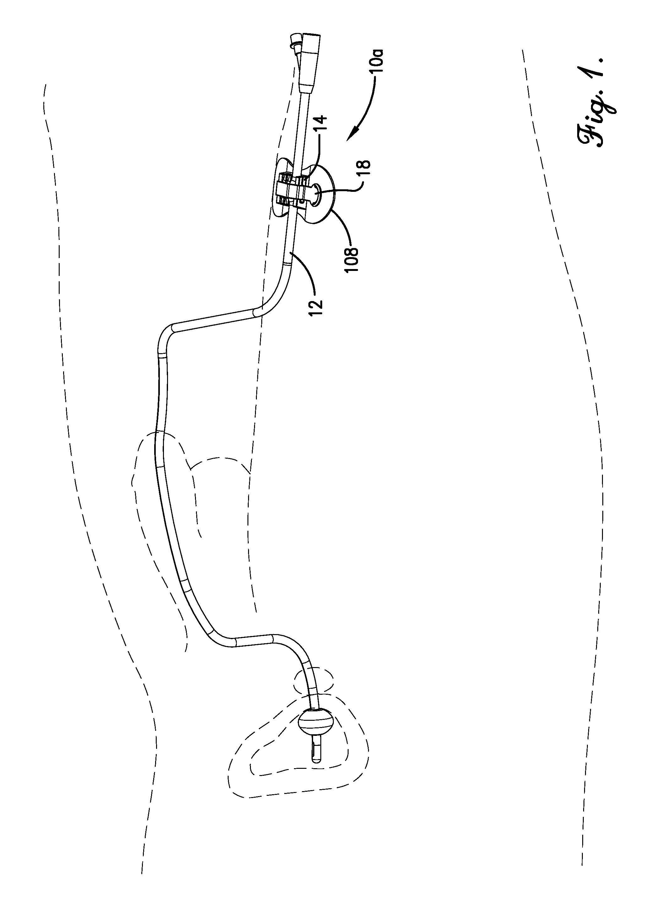 Securement device for medical fixtures