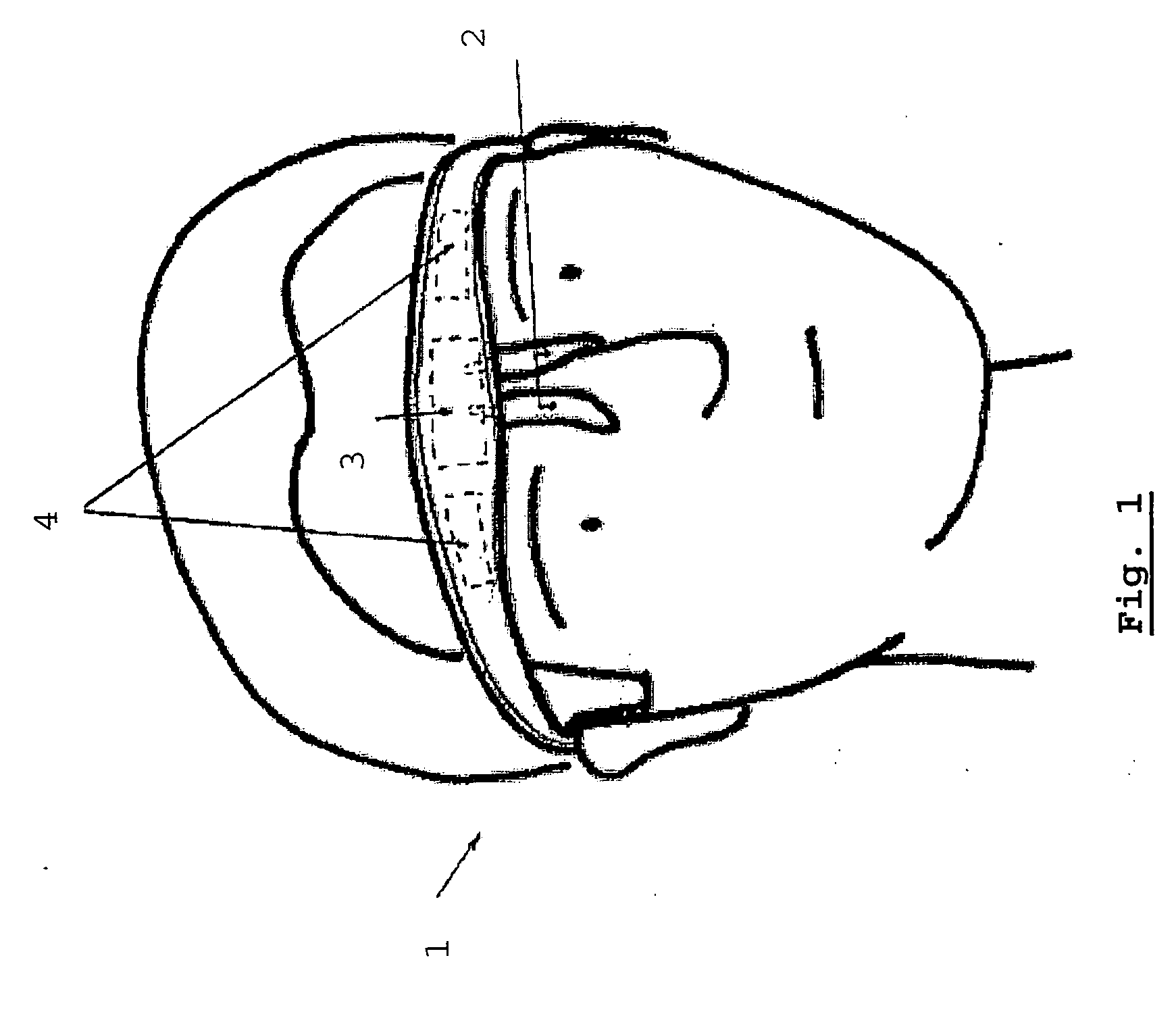 Apparatus For Electro-Inhibition Of Facial Muscles