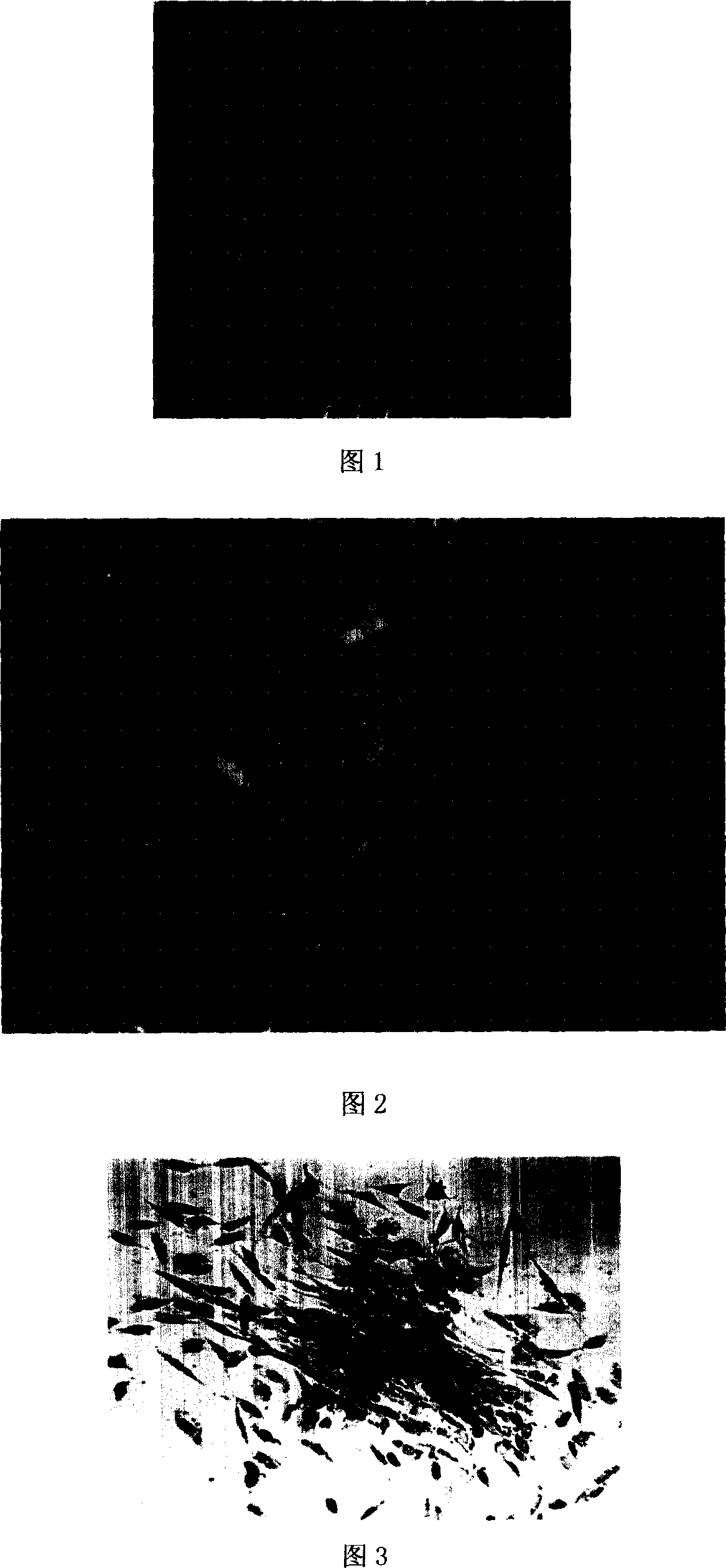 Renal mesenchymoma model and its establishing process and application