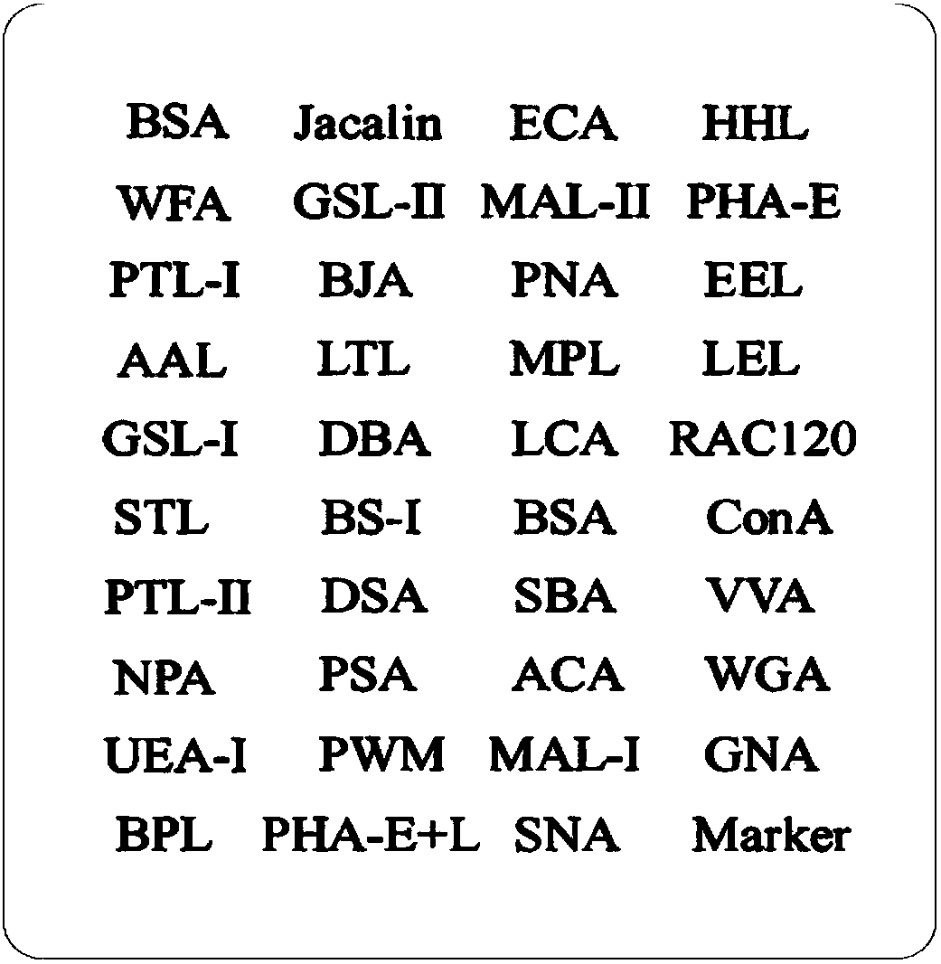 Application of specific lectin combination in preparation of test vector for identifying lung cancer type and stage