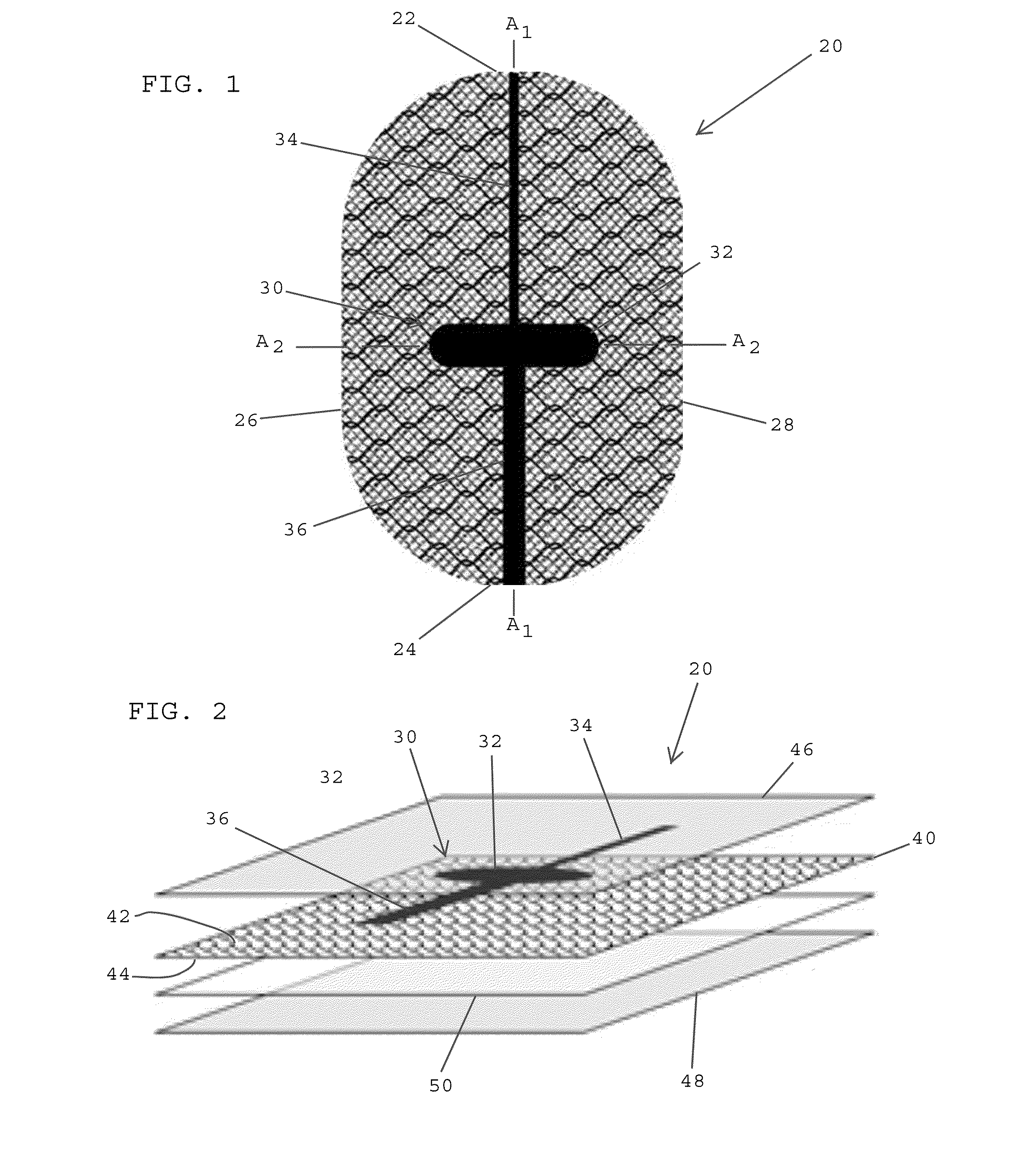 Composite anisotropic tissue reinforcing implants having alignment markers and methods of manufacturing same