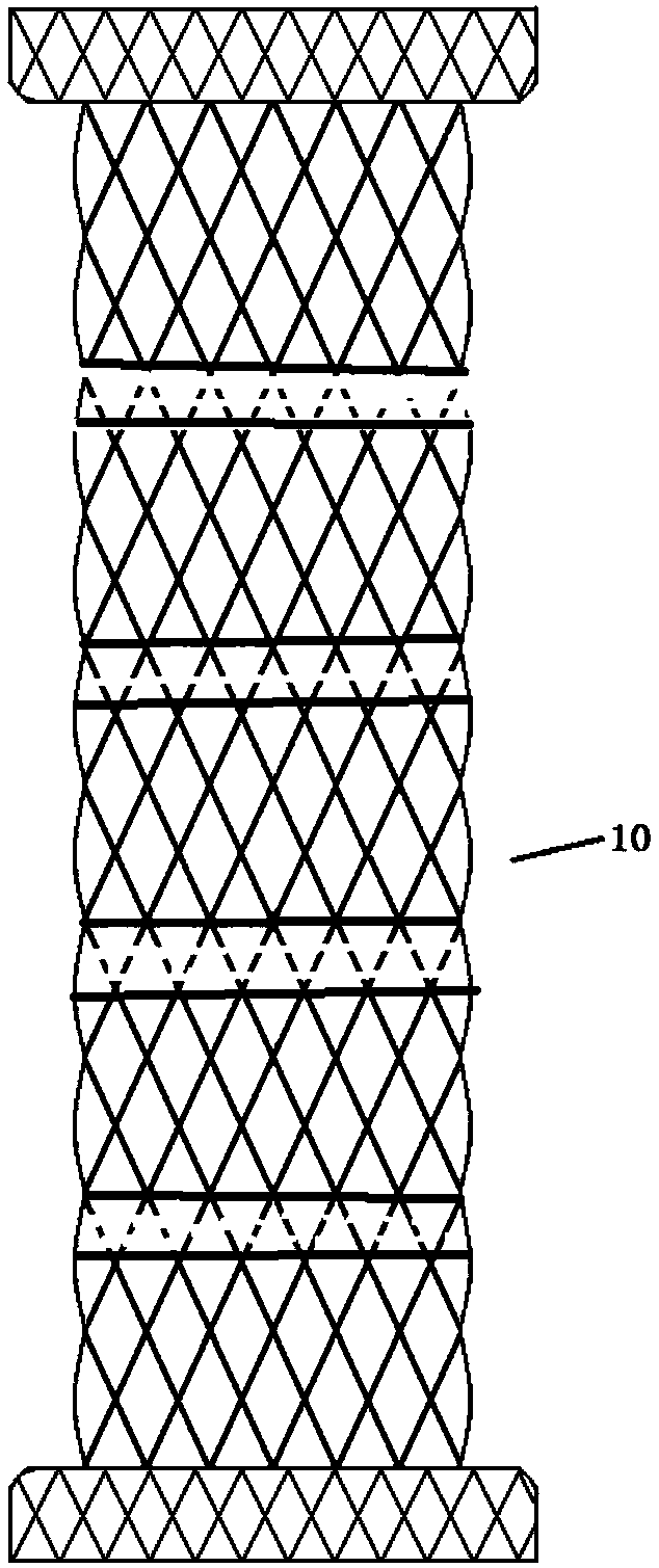 Novel ascites hepatic-vein bypass anti-thrombus stent device with controllable one-way valve