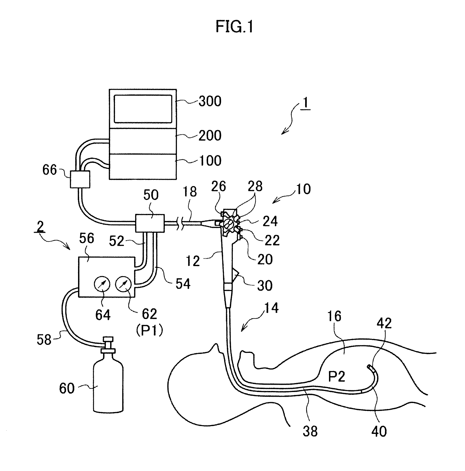 Endoscope air-supply system