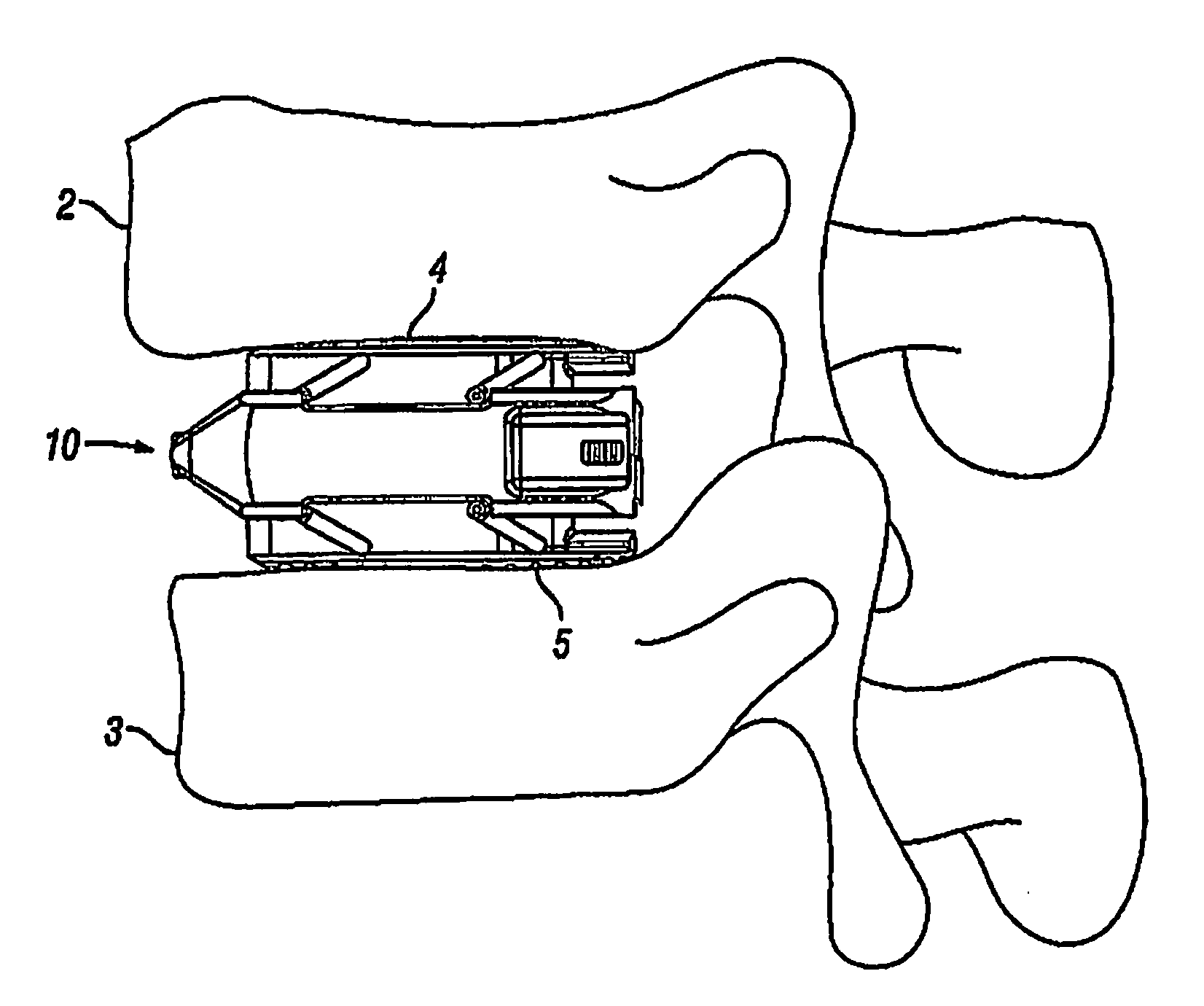 Expandable Fusion Device and Method Installation Thereof