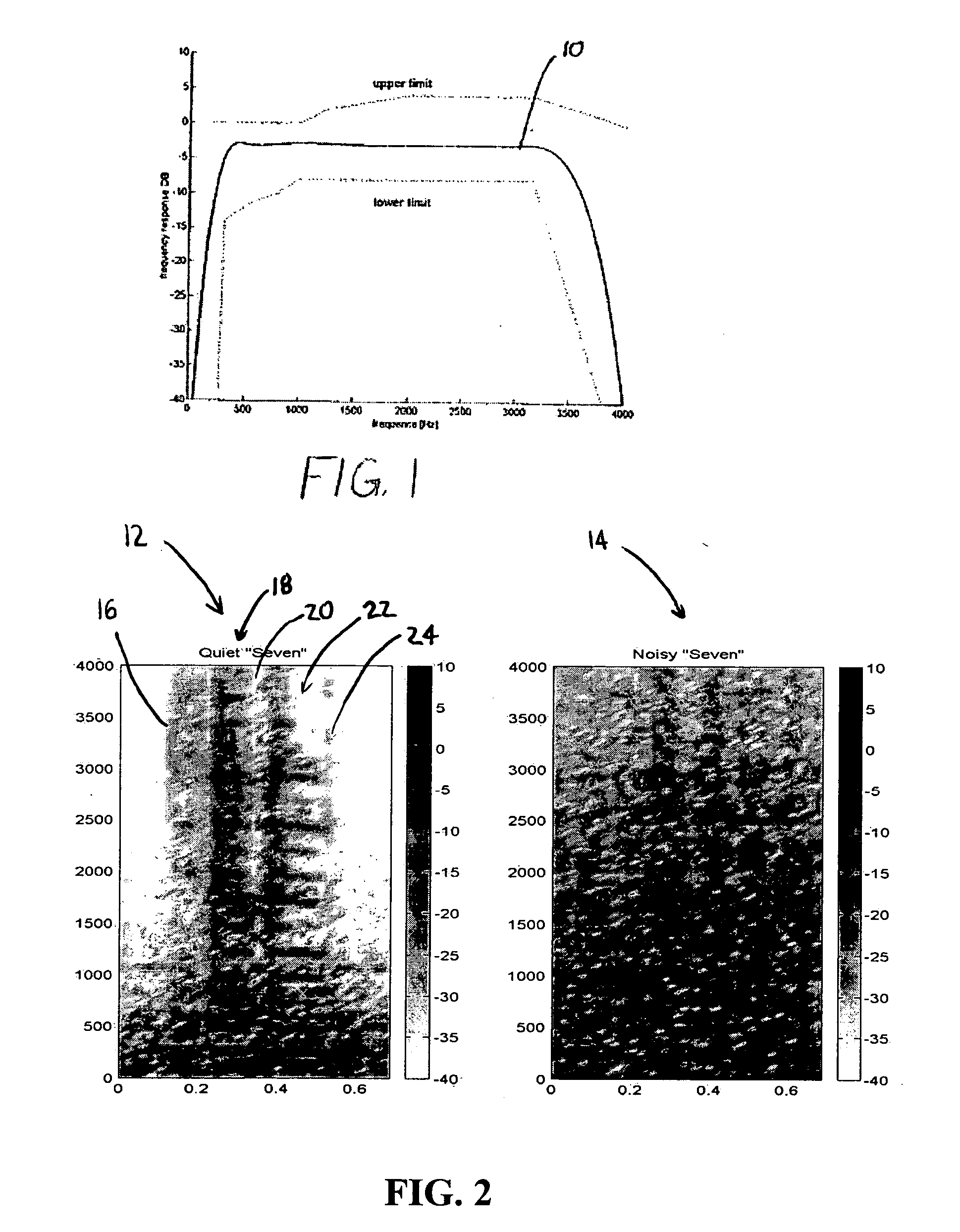 System for improving speech quality and intelligibility