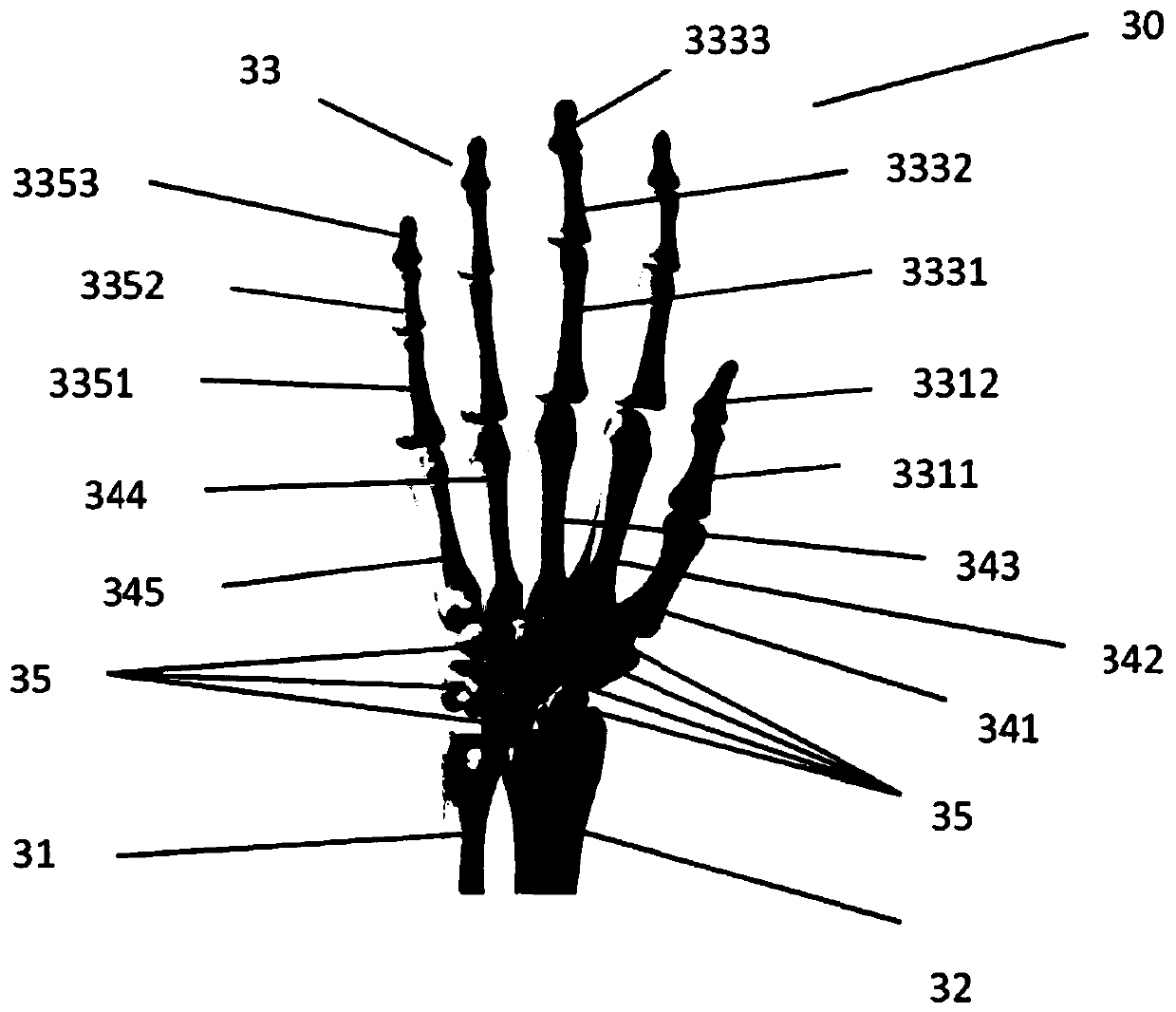 A bone age detection method and device based on deep learning