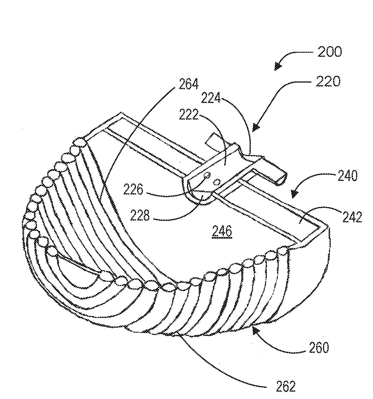 Left atrial appendage occlusion device