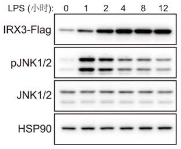 Application of IRX3 protein to prevention and treatment of obesity, metaflammation and related diseases