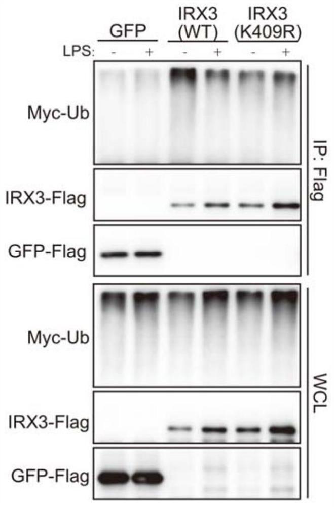 Application of IRX3 protein to prevention and treatment of obesity, metaflammation and related diseases