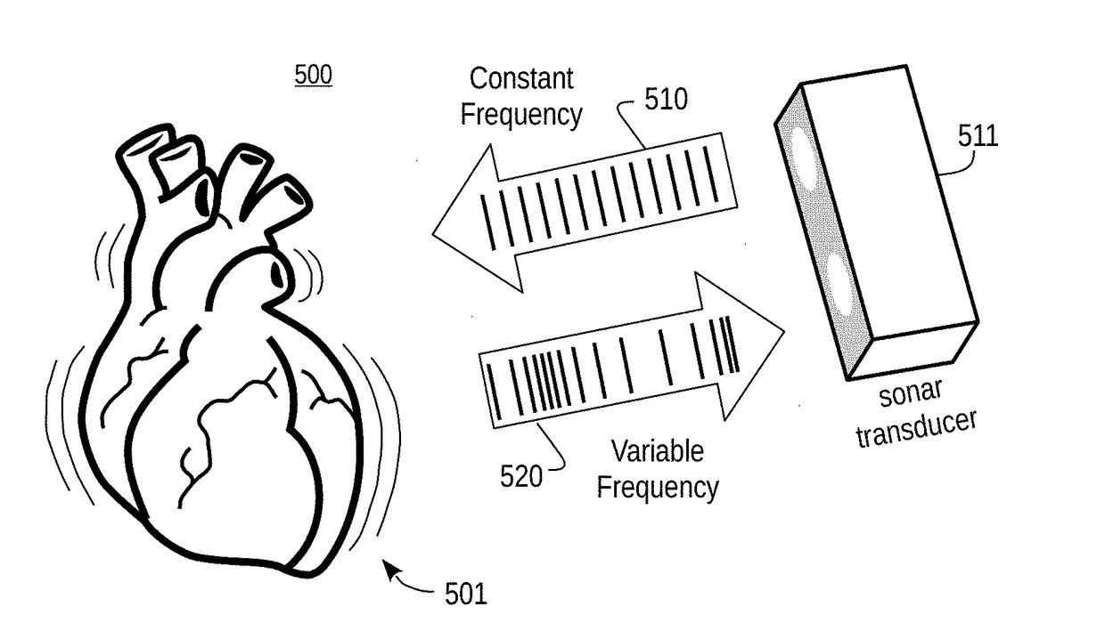 Continuous wave doppler detection of rosc