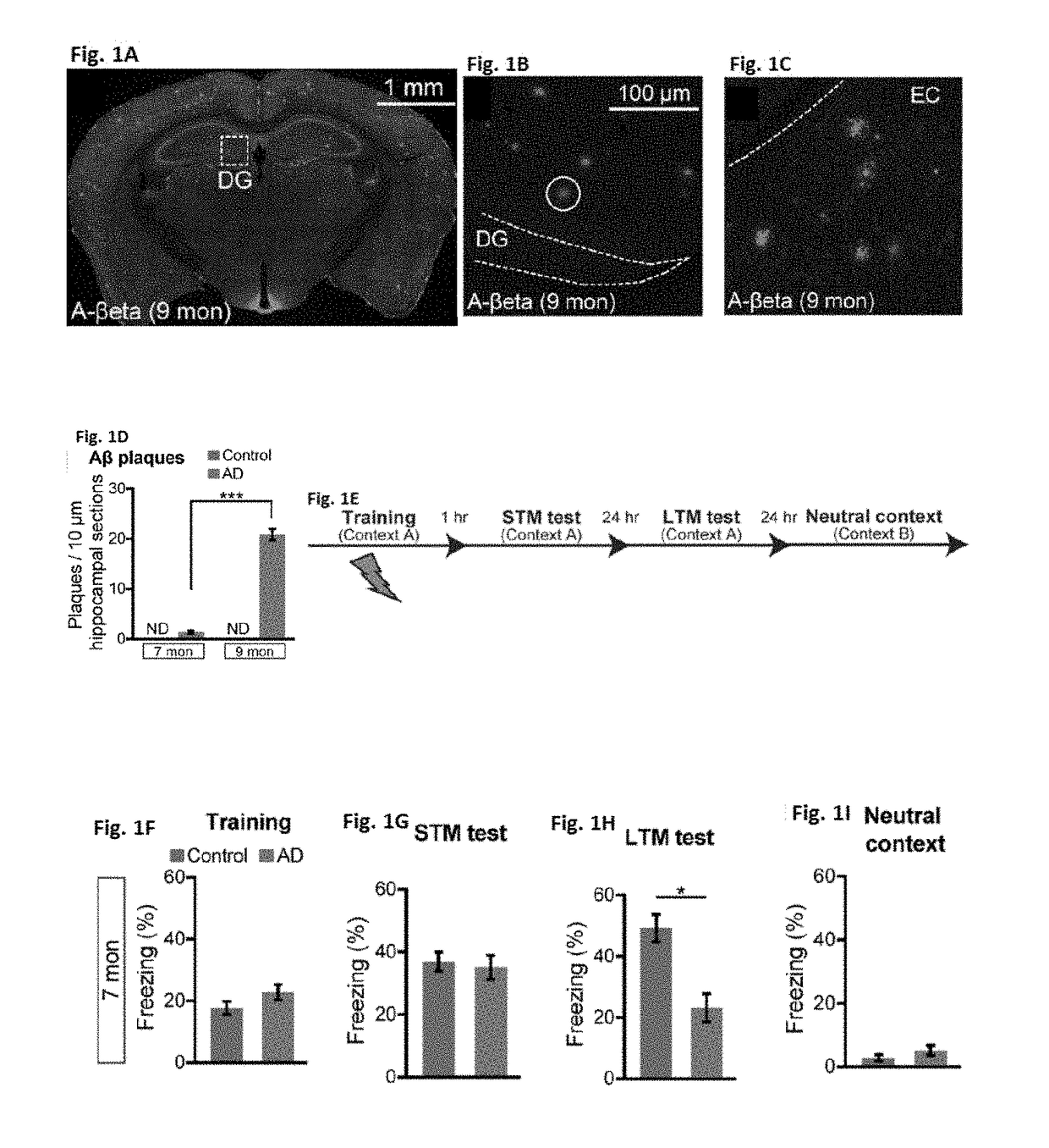 Methods and compositions for treating alzheimer's disease and other memory-associated disorders and conditions