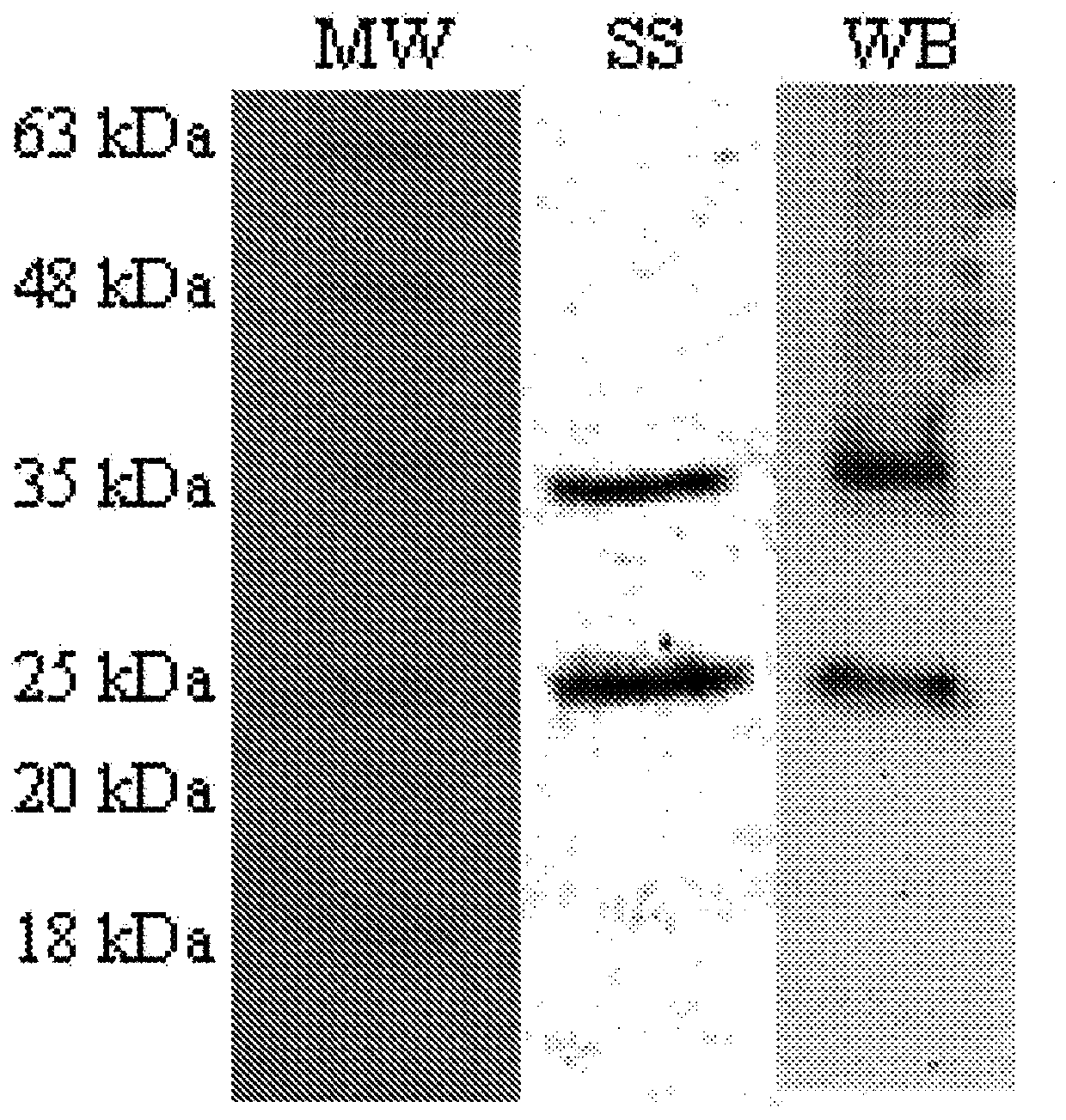 Ligands of the fsh hormone receptor in the diagnosis and treatment of tumors