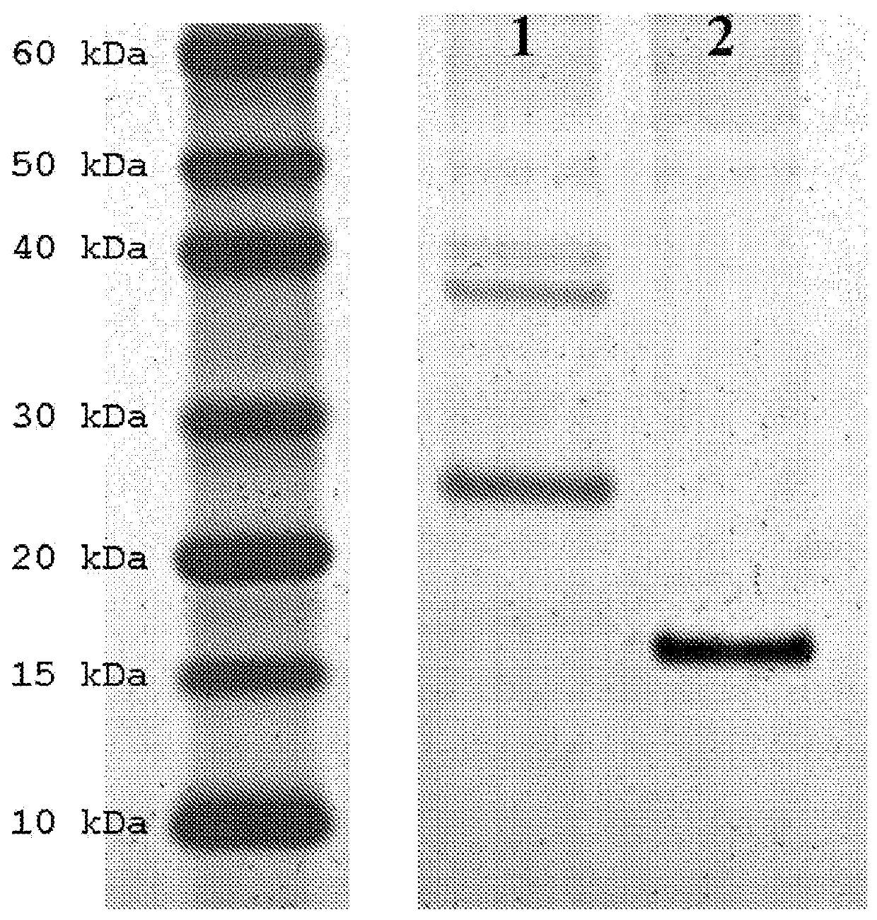 Ligands of the fsh hormone receptor in the diagnosis and treatment of tumors