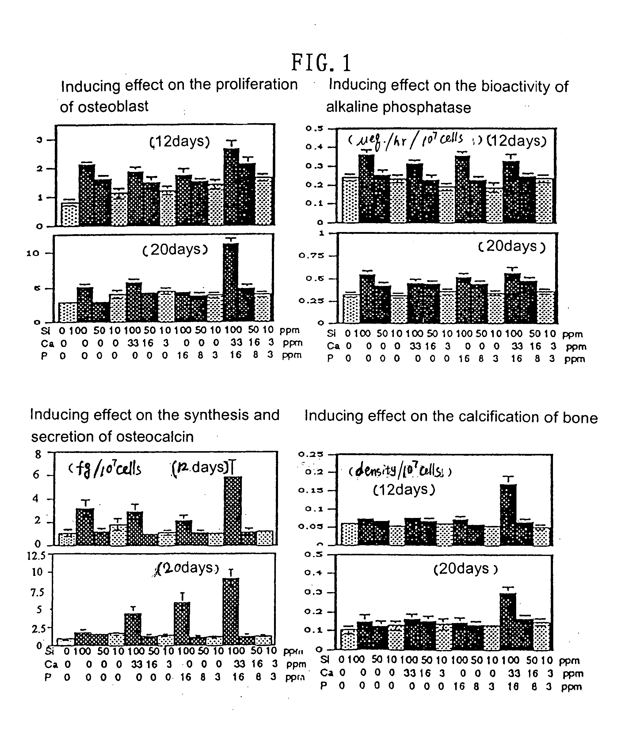 Scaffold product for human bone tissue engineering, methods for its preparation and uses thereof