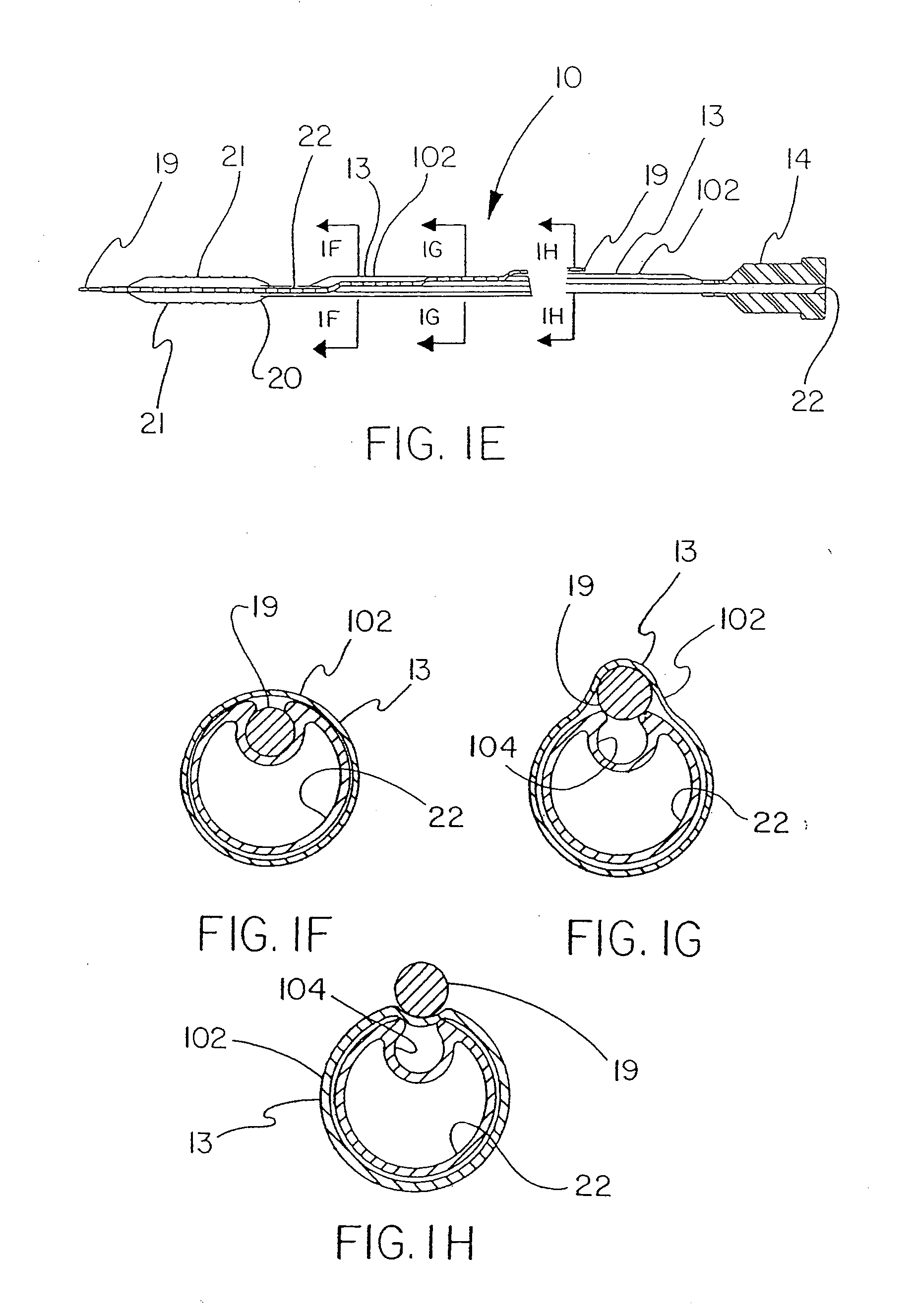 Catheter Assembly