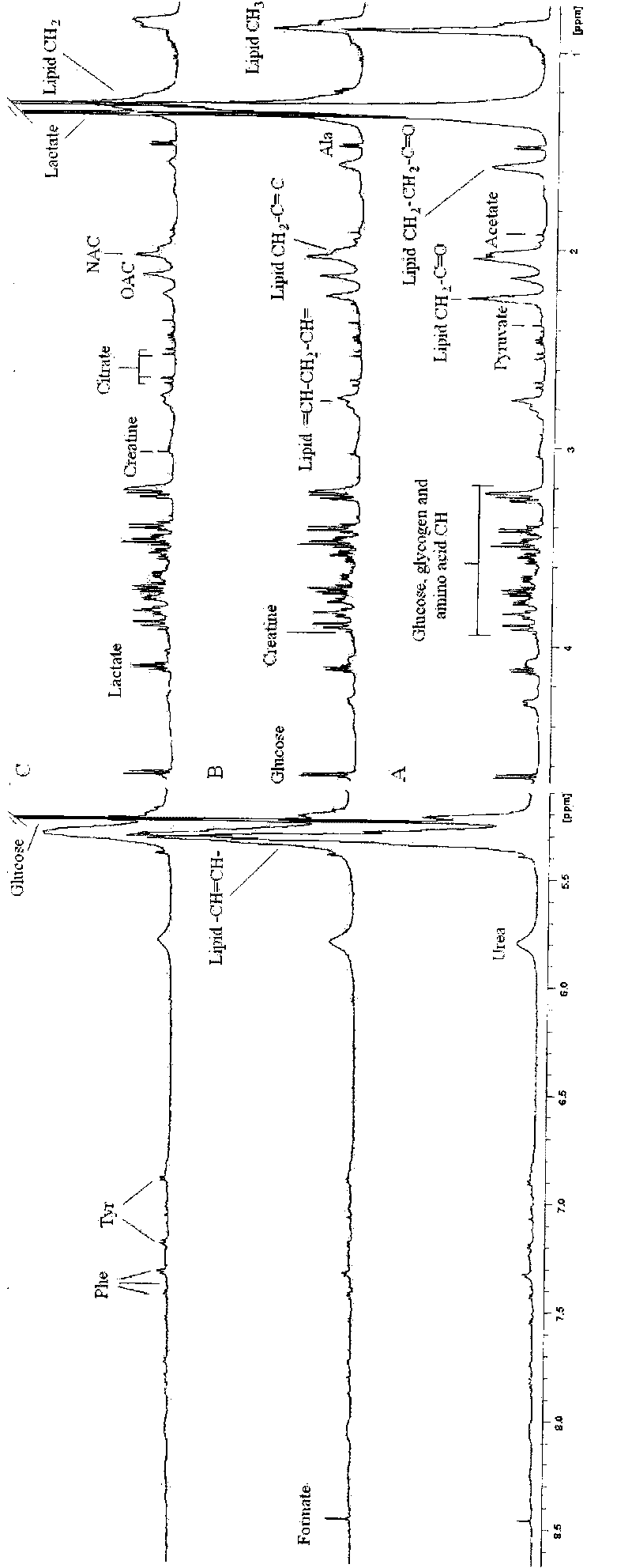 Application of metabonomic technology in intrauterine growth retardation