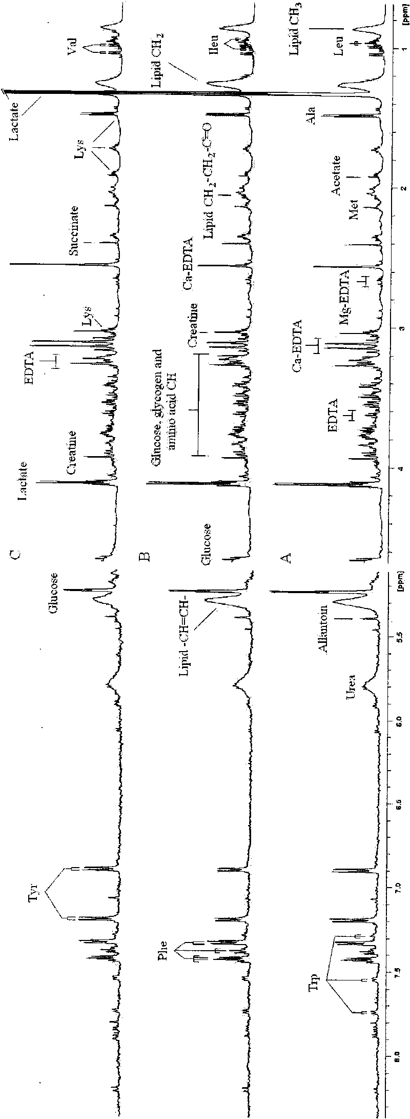 Application of metabonomic technology in intrauterine growth retardation