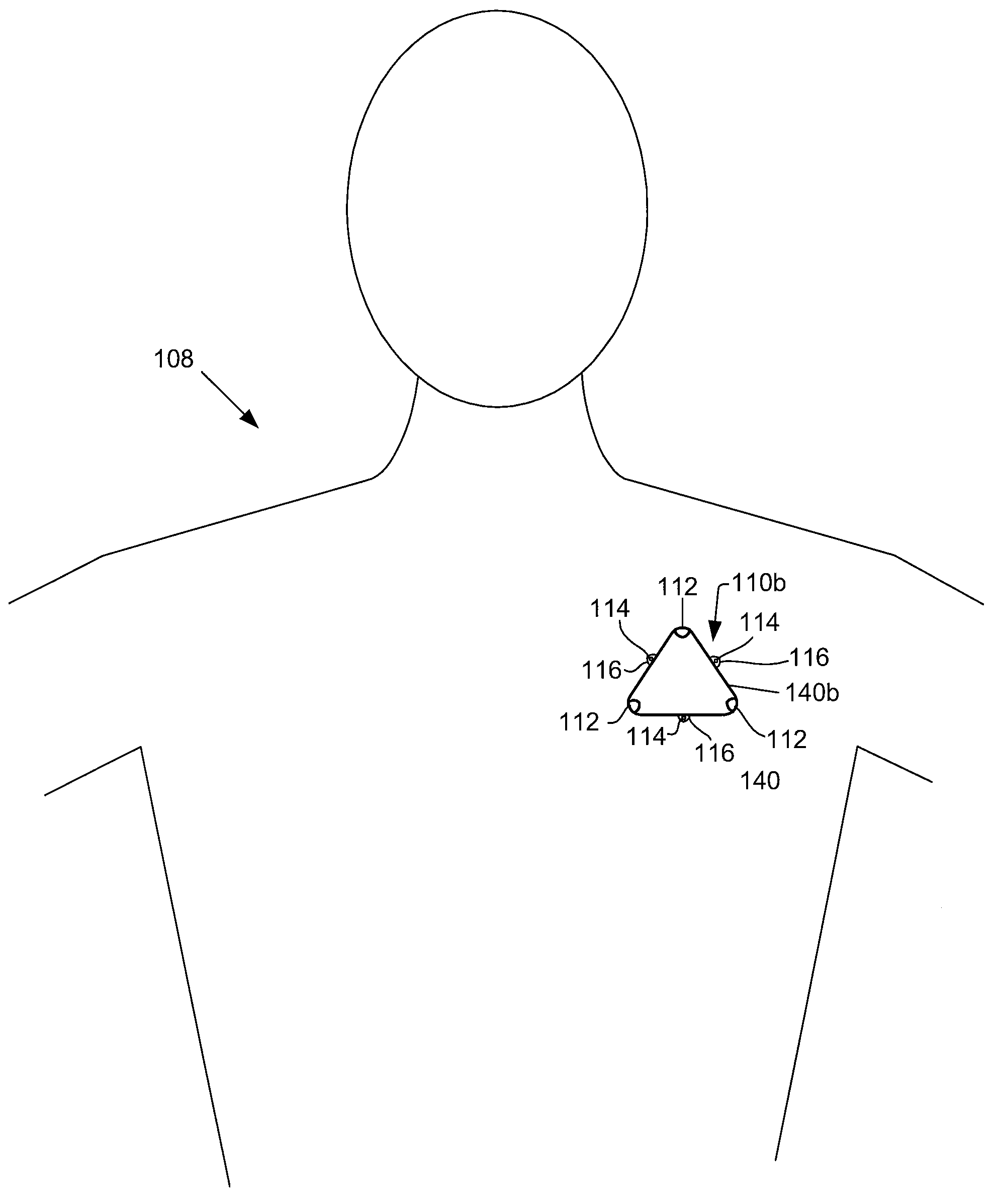 Noise detection and response for use when monitoring for arrhythmias