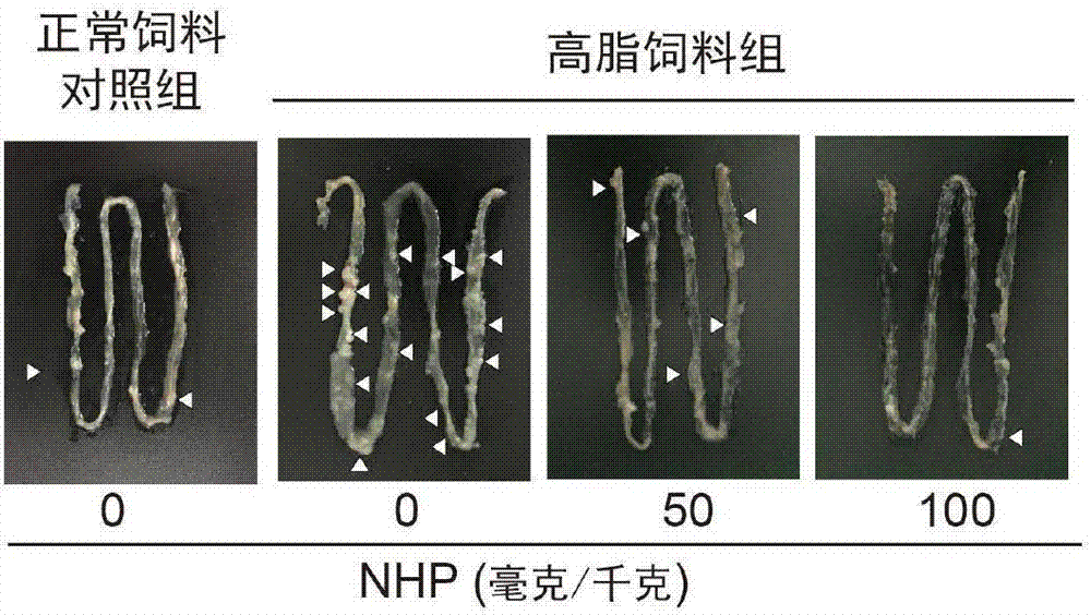 Application of neohesperidin in preparation of tumor prevention and treatment drugs